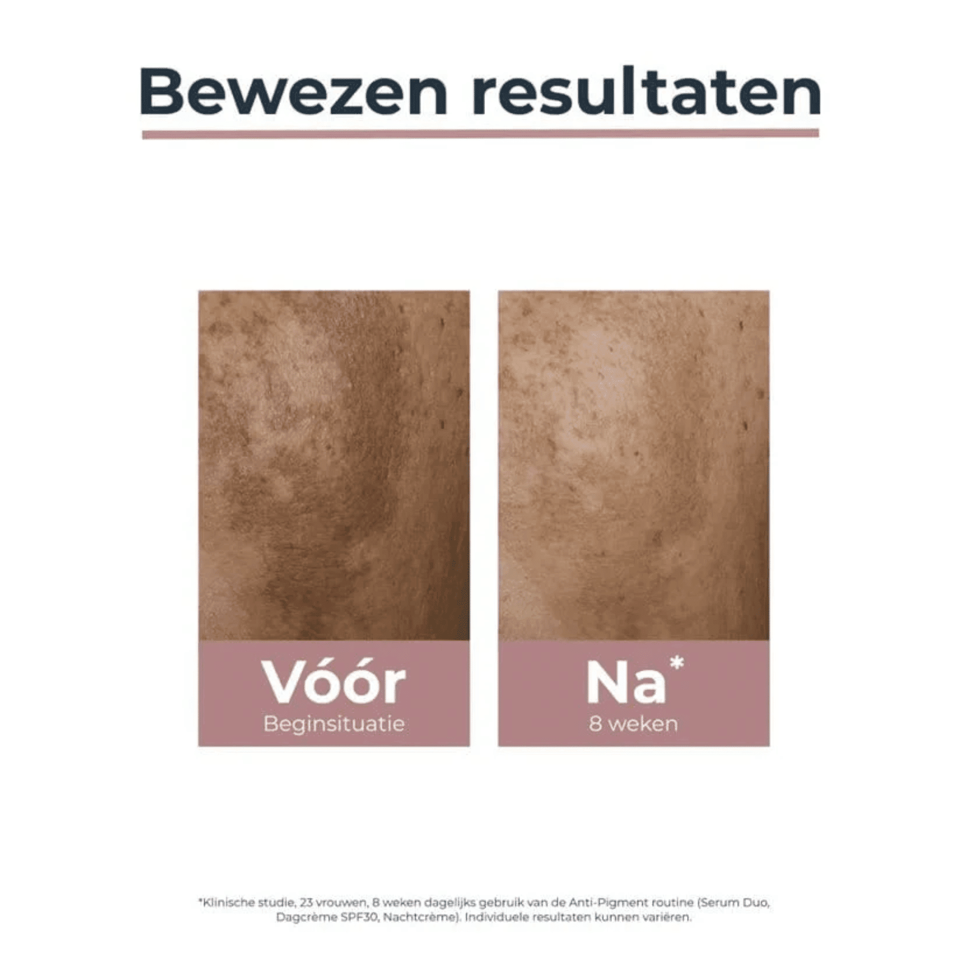 Eucerin Anti-Pigment Dagcrème SPF 30