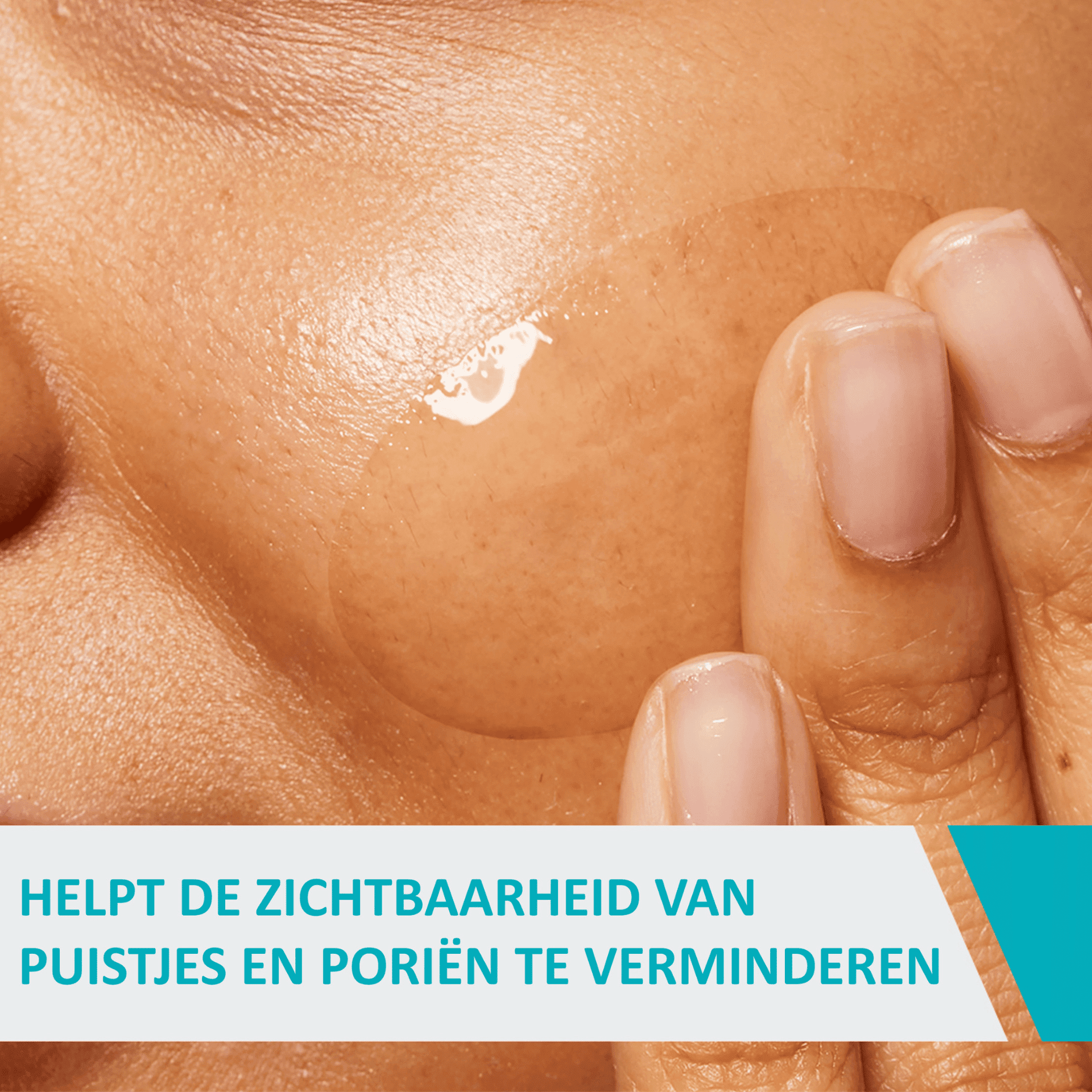 CeraVe Geconcentreerde Anti-Onzuiverheden Verzorging CeraVe Geconcentreerde Anti-Onzuiverheden Verzorging