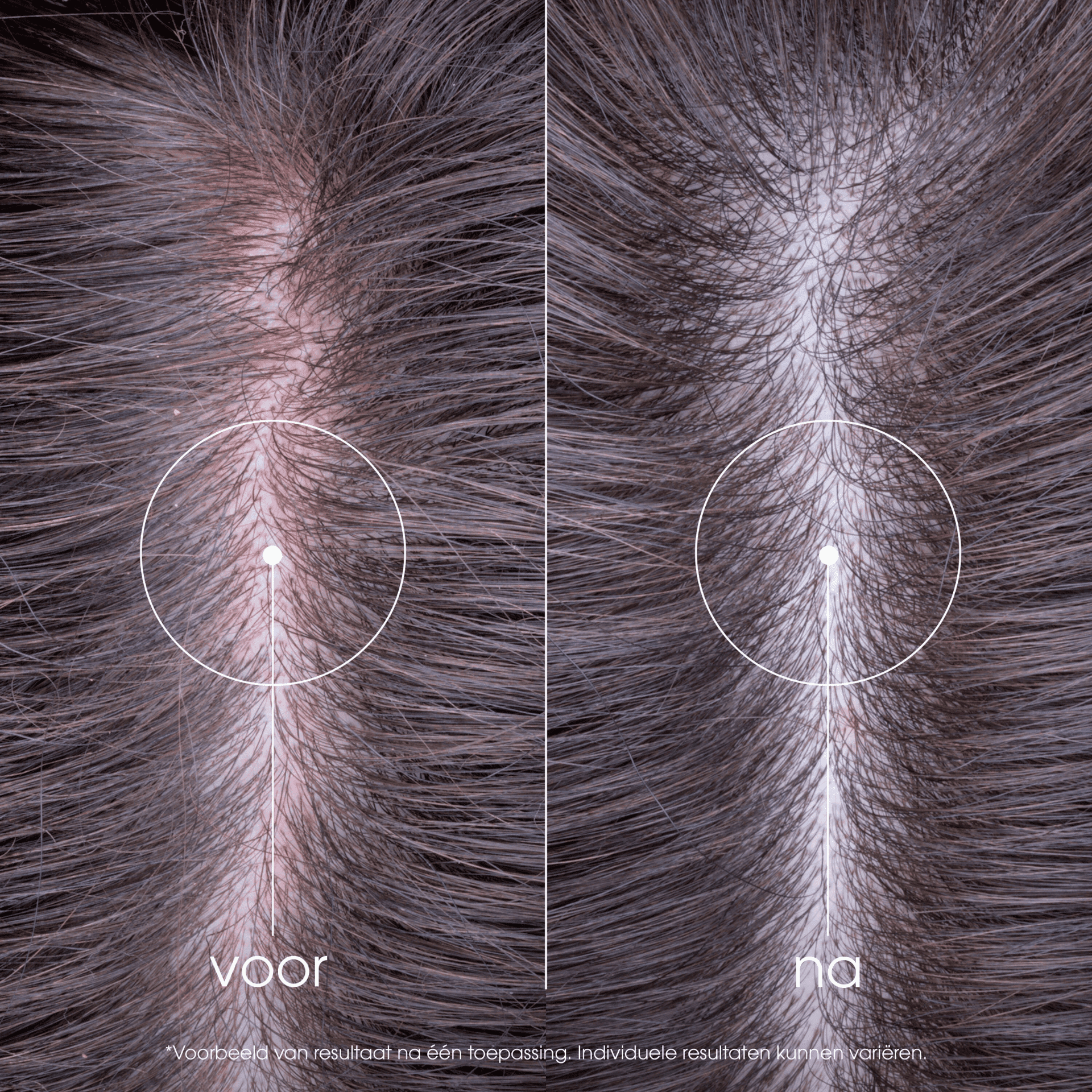 Klorane Pioenroos Kalmerende Shampoo