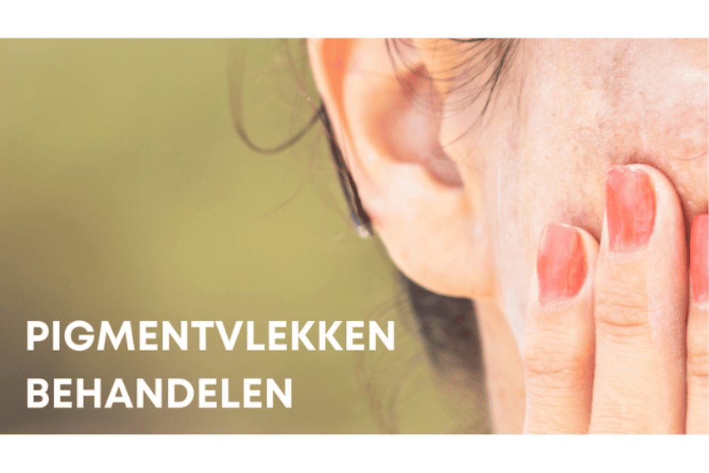 Pigmentvlekken behandelen Gezicht met pigmentvlekken