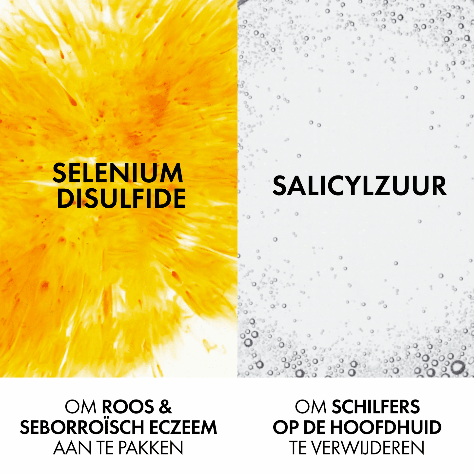 Vichy Dercos Anti-Roos DS Normaal tot Vet Haar
