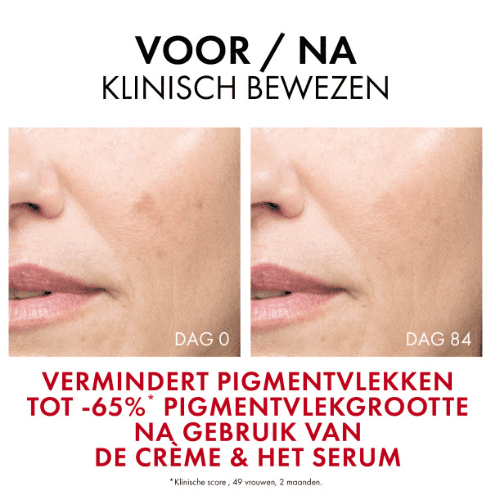 Vichy Liftactiv Pigment Specialist B3 Dagcrème SPF 50