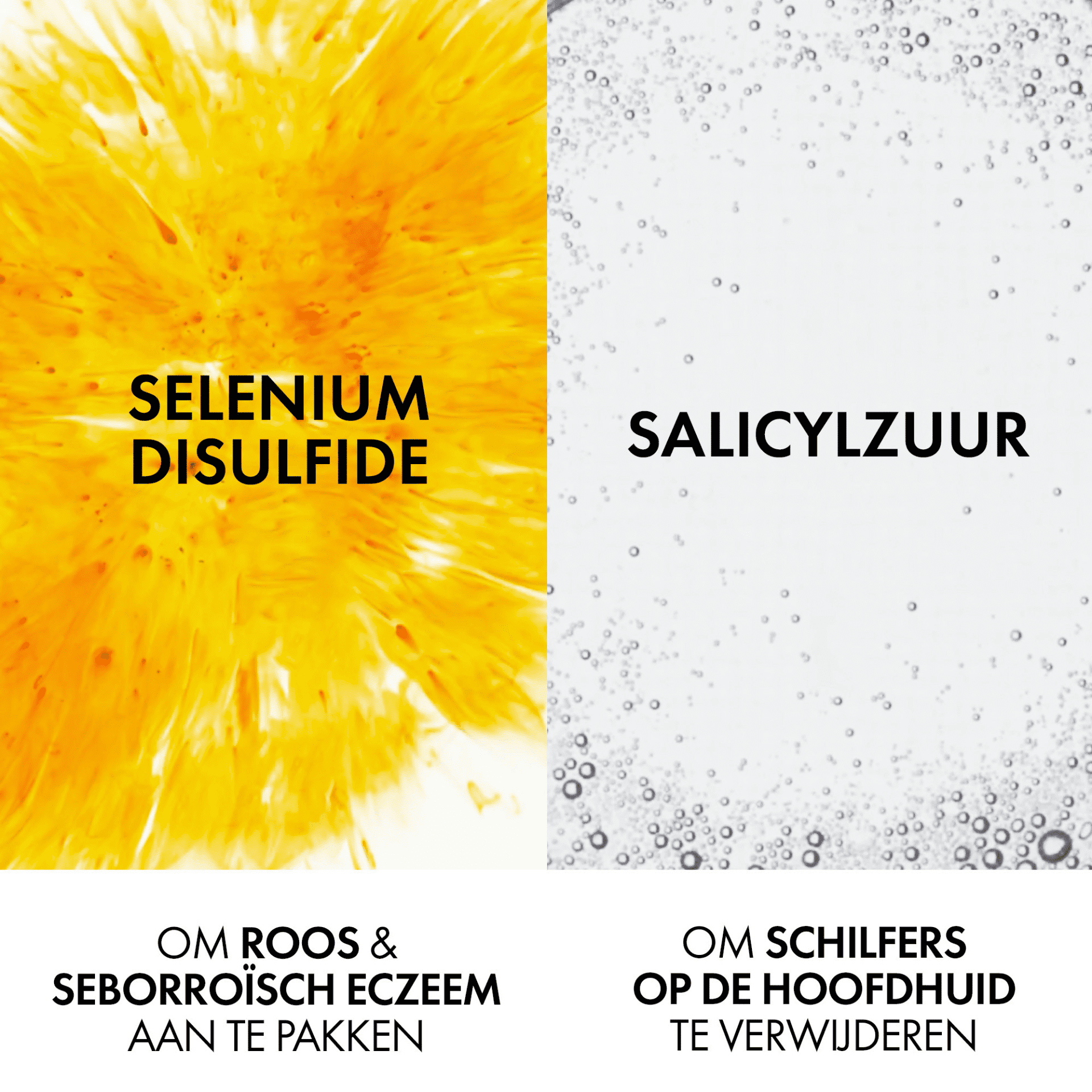 Vichy Dercos Anti-Roos DS Droog Haar Vichy Dercos Anti-Roos DS Droog Haar