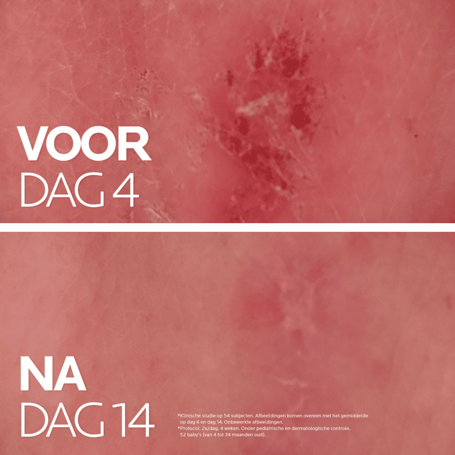 La Roche-Posay Cicaplast B5+ Balsem La Roche-Posay Cicaplast B5+ Balsem