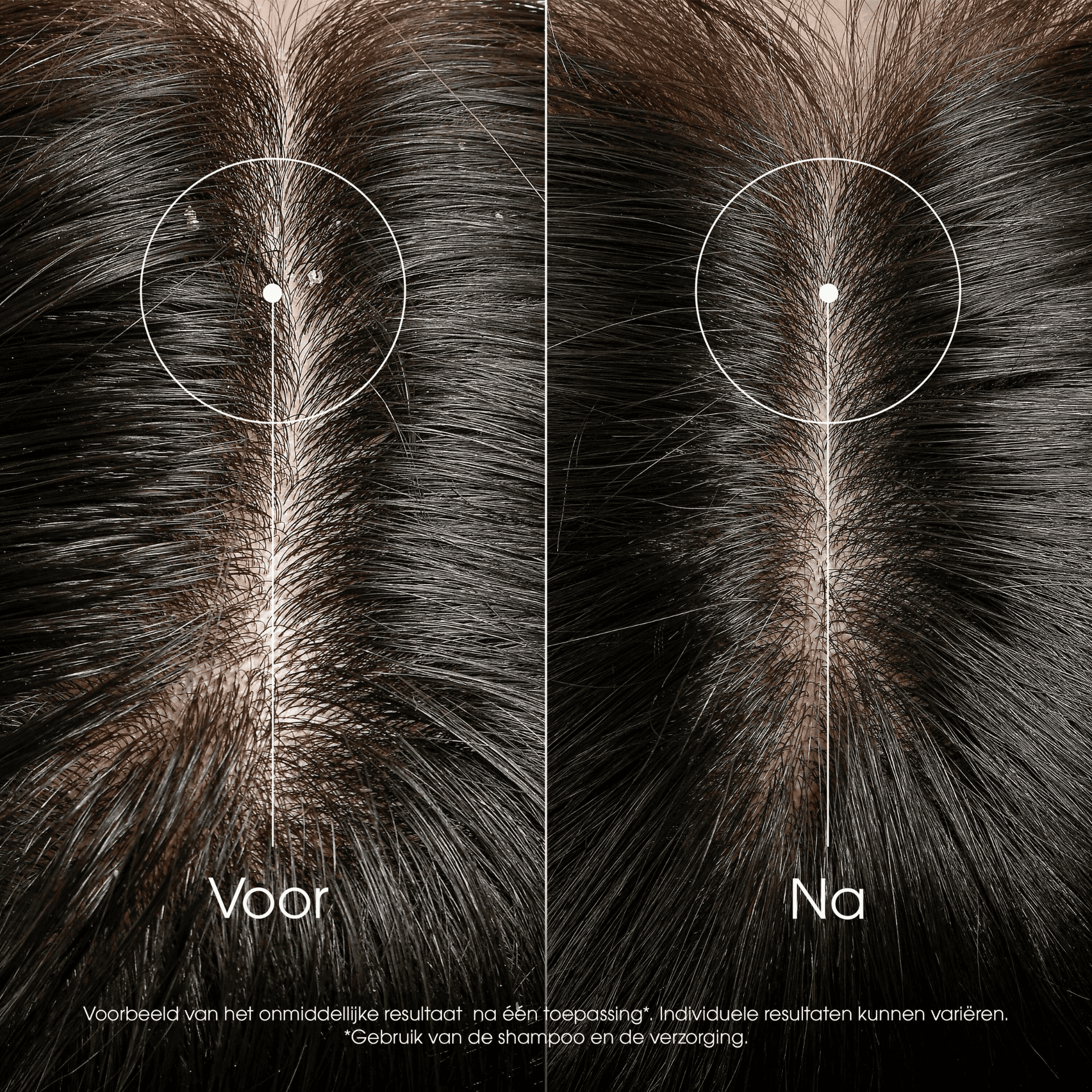 Klorane Galanga Antiroosverzorging tegen Jeuk Klorane Galanga Antiroosverzorging tegen Jeuk