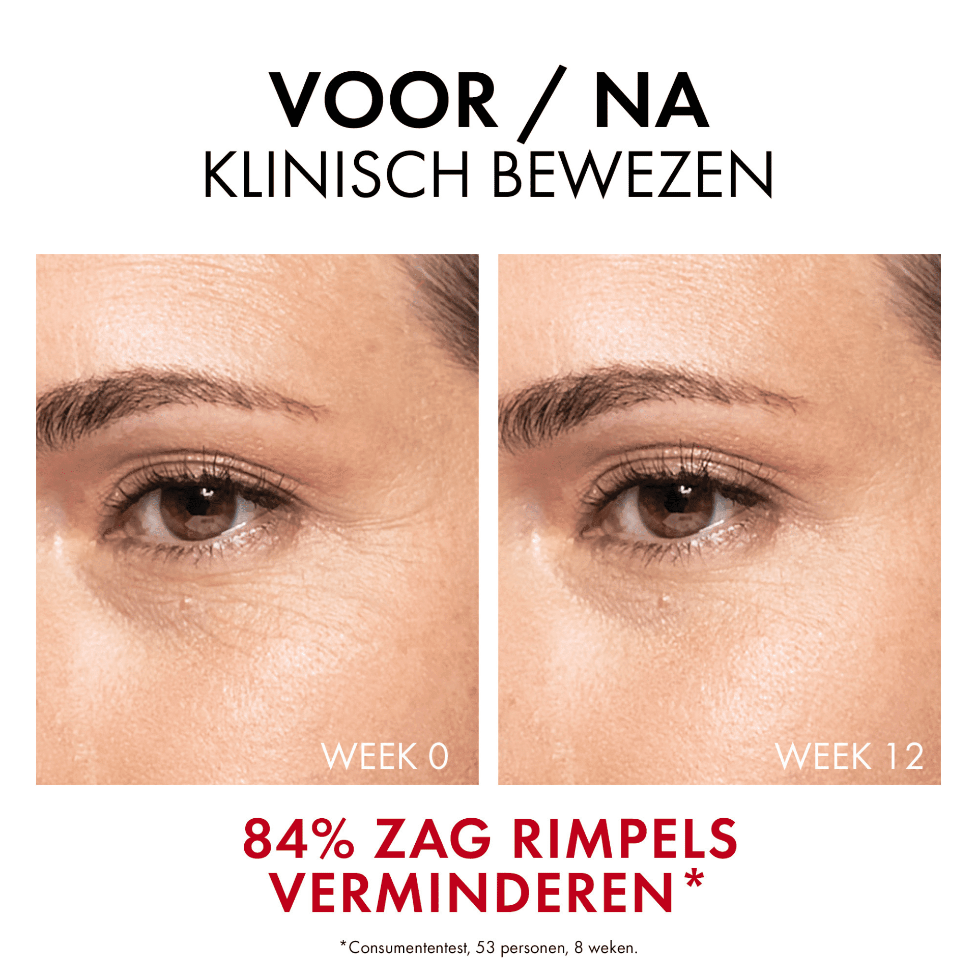 Vichy Liftactiv Collagen Specialist 16 Serum