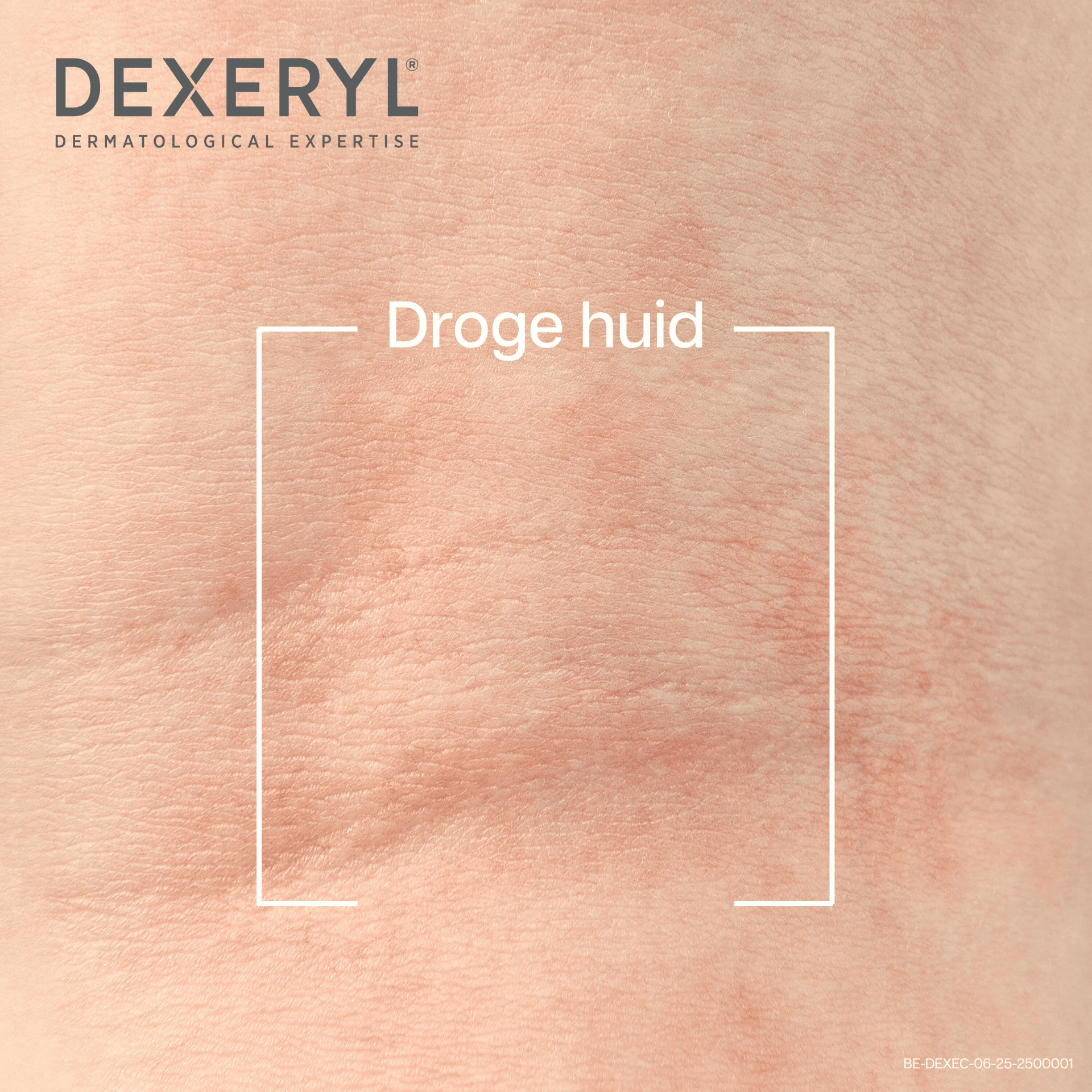 Dexeryl Verzachtende Crème