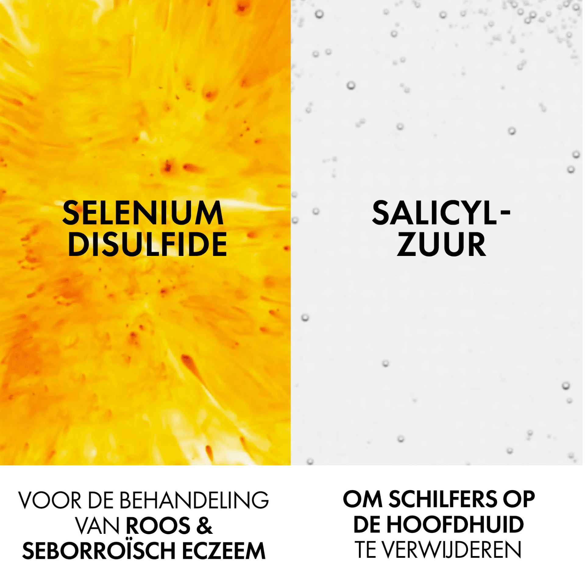 Vichy Dercos Anti-Roos DS Droog Haar Vichy Dercos Anti-Roos DS Droog Haar