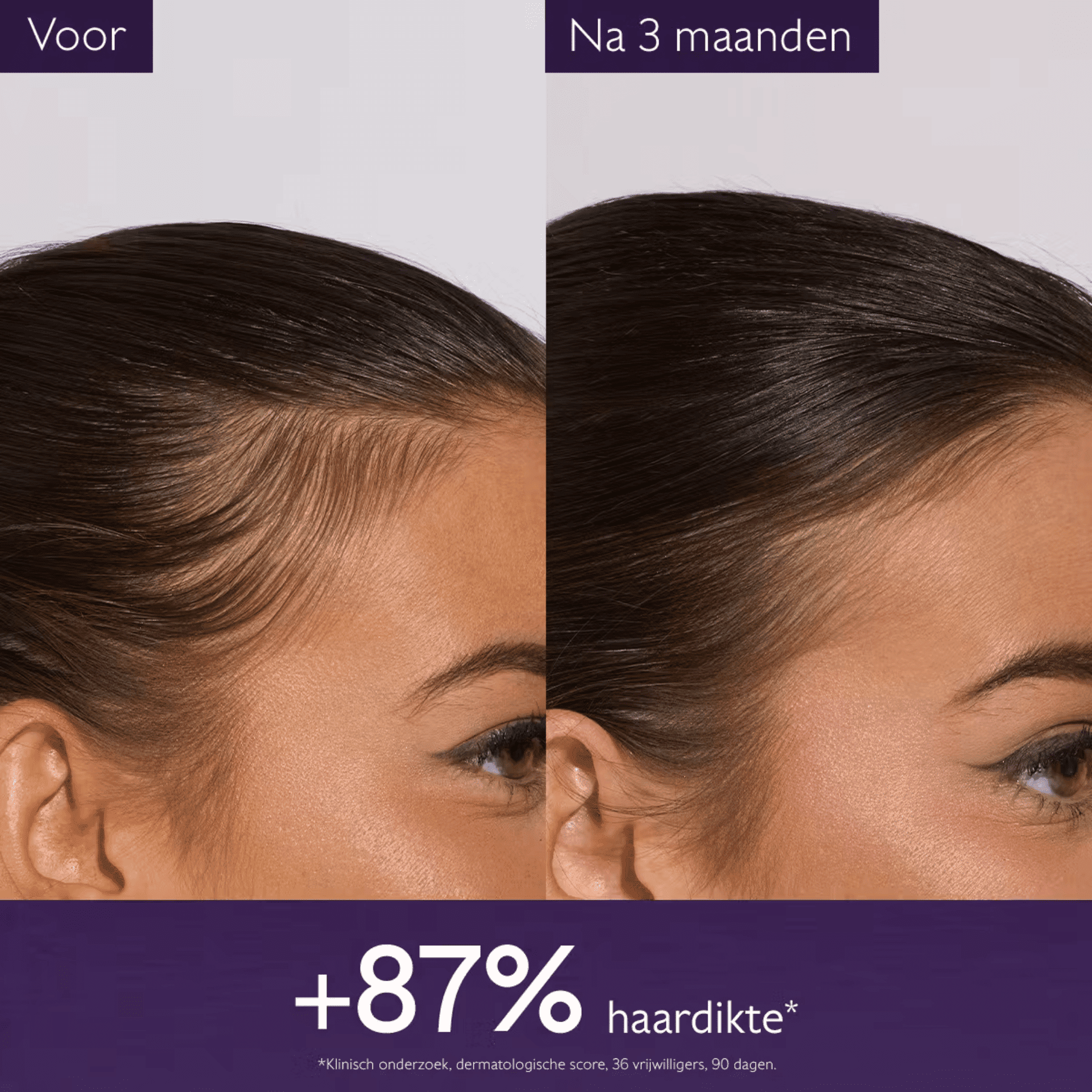 Caudalie Anti-haaruitval Serum Caudalie Anti-haaruitval Serum