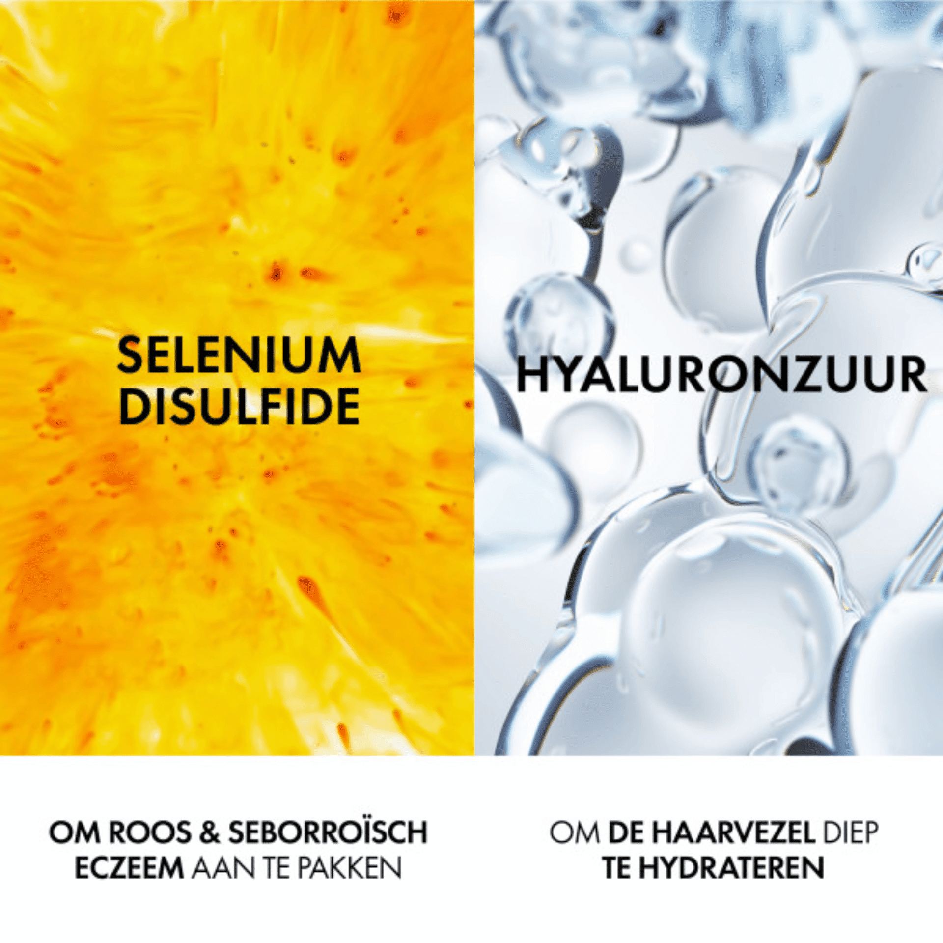 Vichy Dercos Anti-Roos DS 2-in-1 Shampoo & Conditioner Vichy Dercos Anti-Roos DS 2-in-1 Shampoo & Conditioner