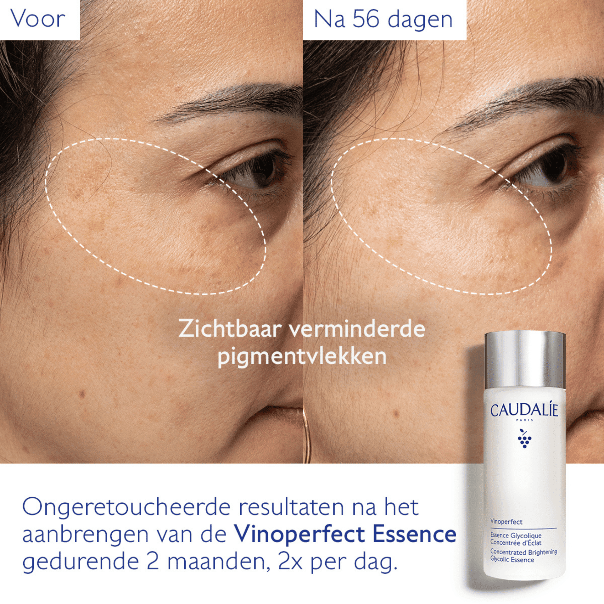 Caudalie Vinoperfect Essence Glycolique Conc.100ml