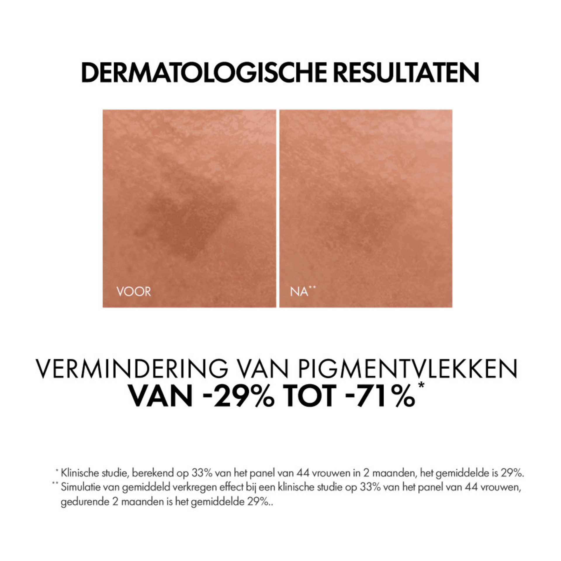 Vichy Liftactiv Specialist B3 Serum