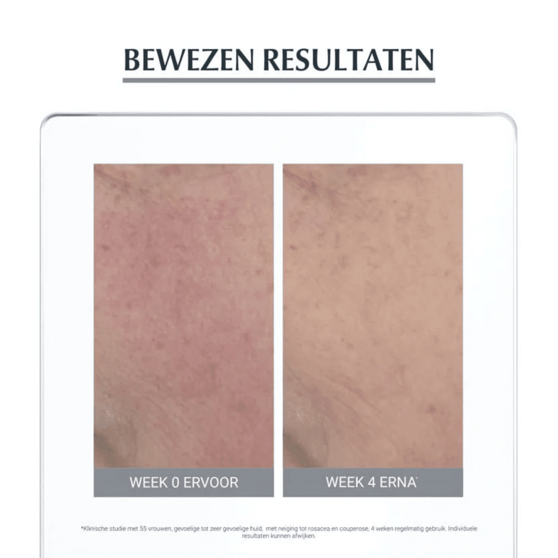 Eucerin AntiRedness Kalmerende Verzorging