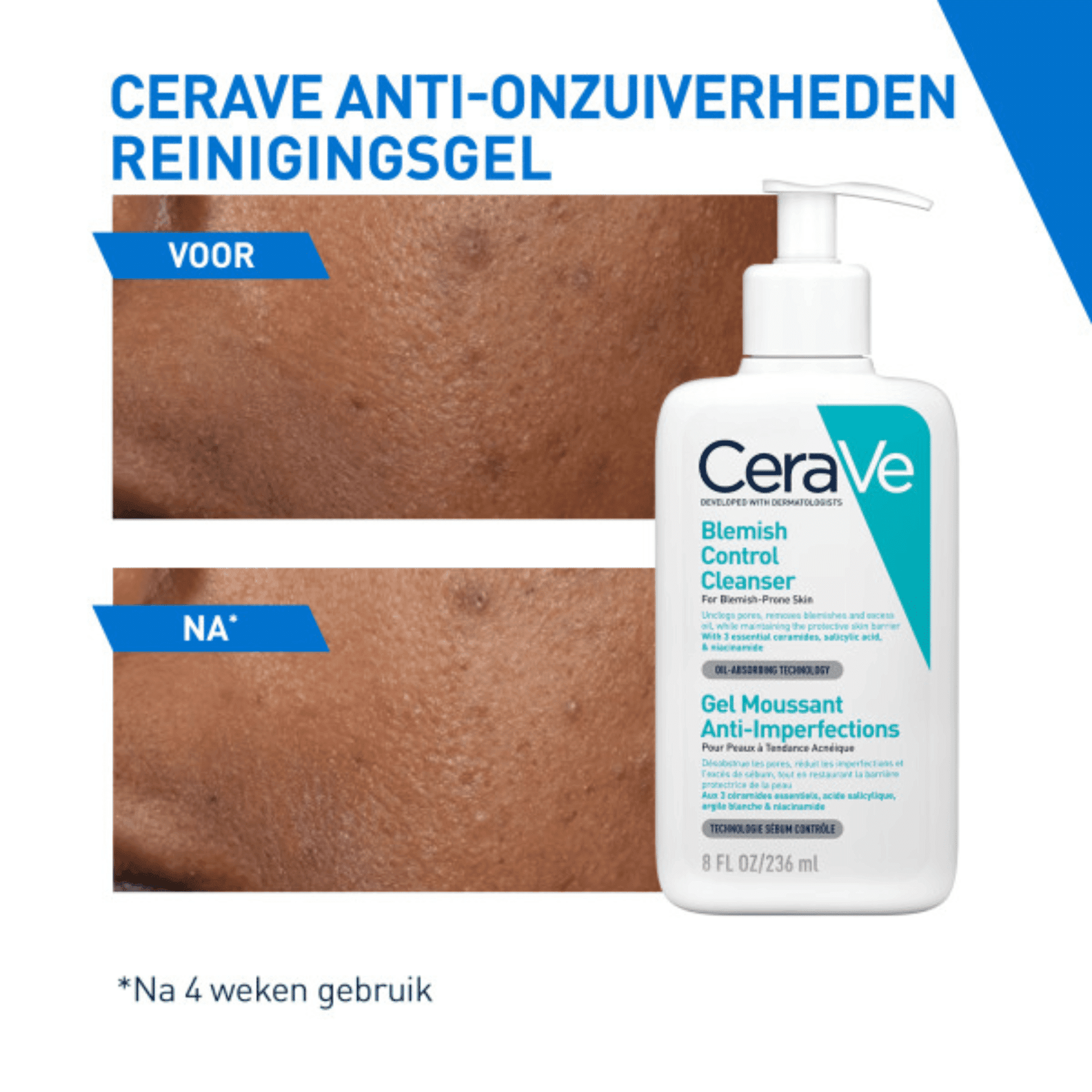 CeraVe Anti-Onzuiverheden Reinigingsgel
