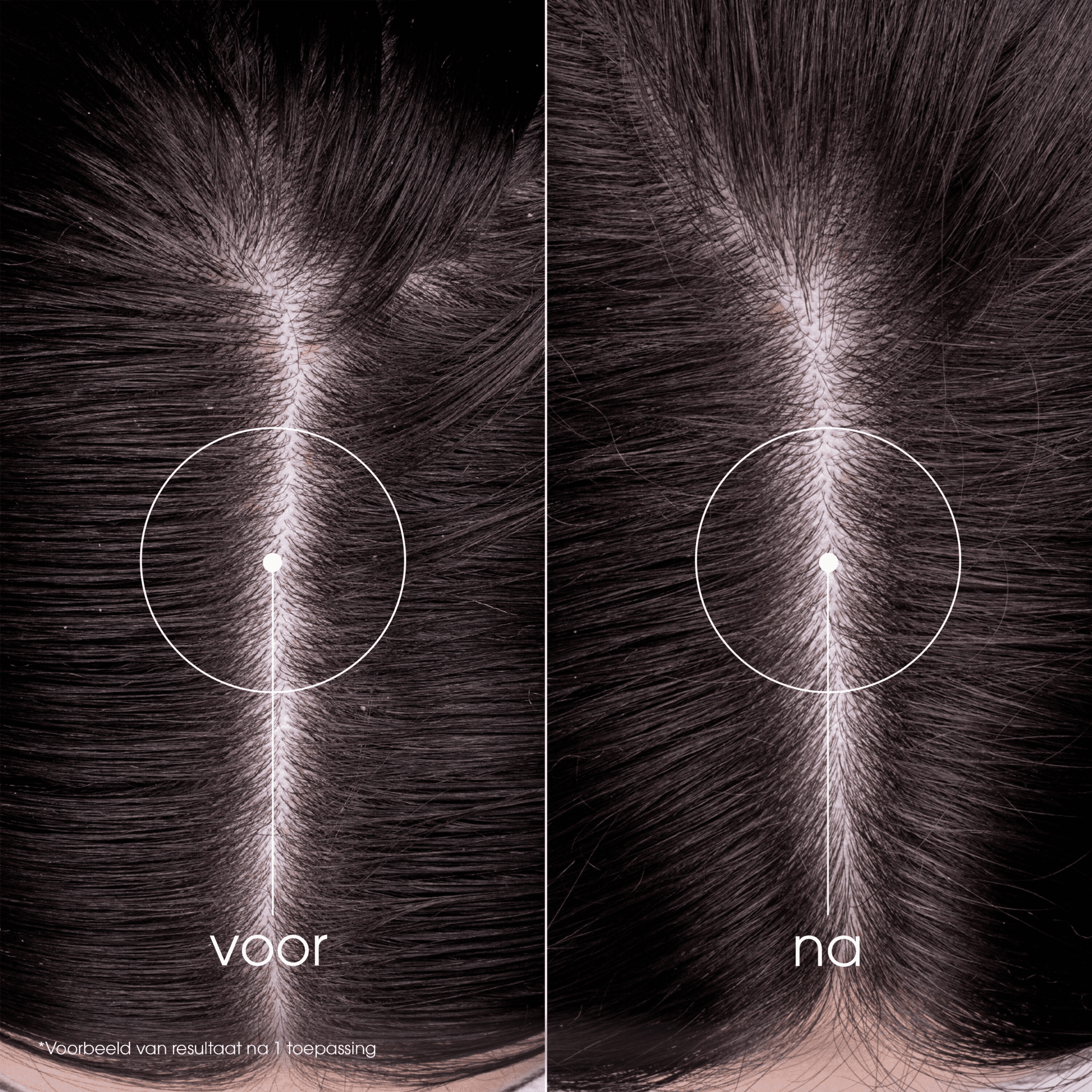 Klorane Brandnetel Talgregulerende Shampoo