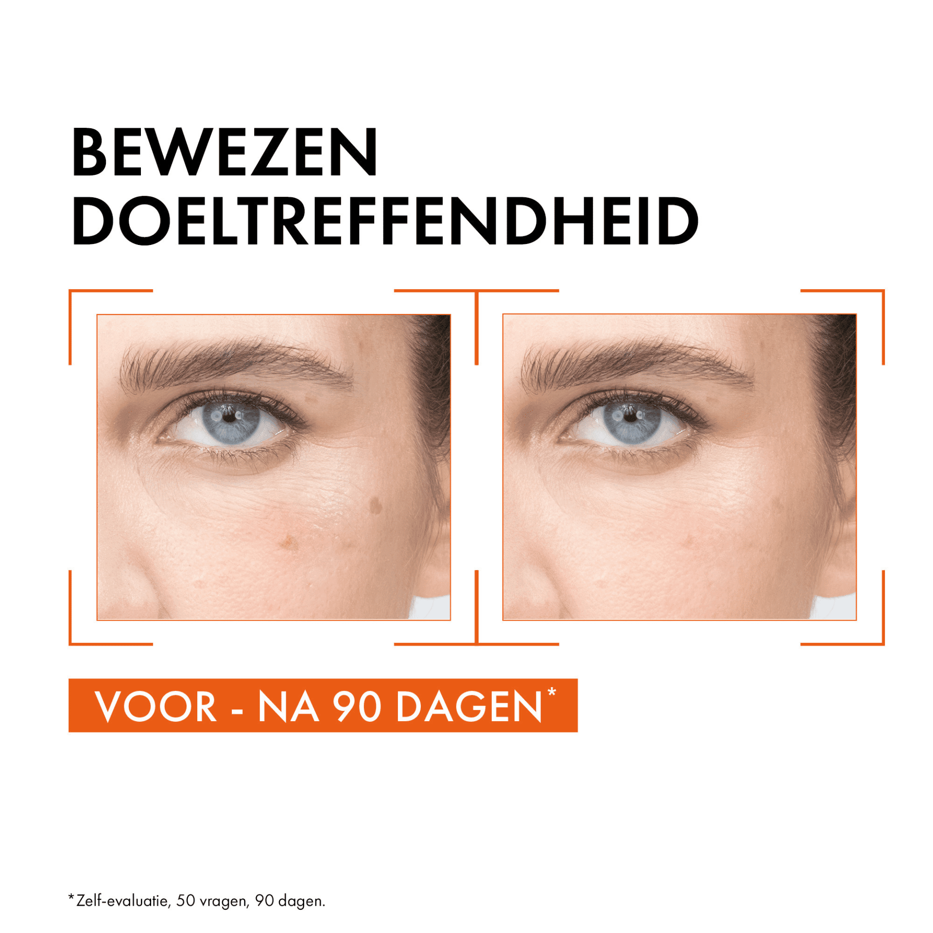 Vichy Liftactiv 16% Pure Vitamine C Serum