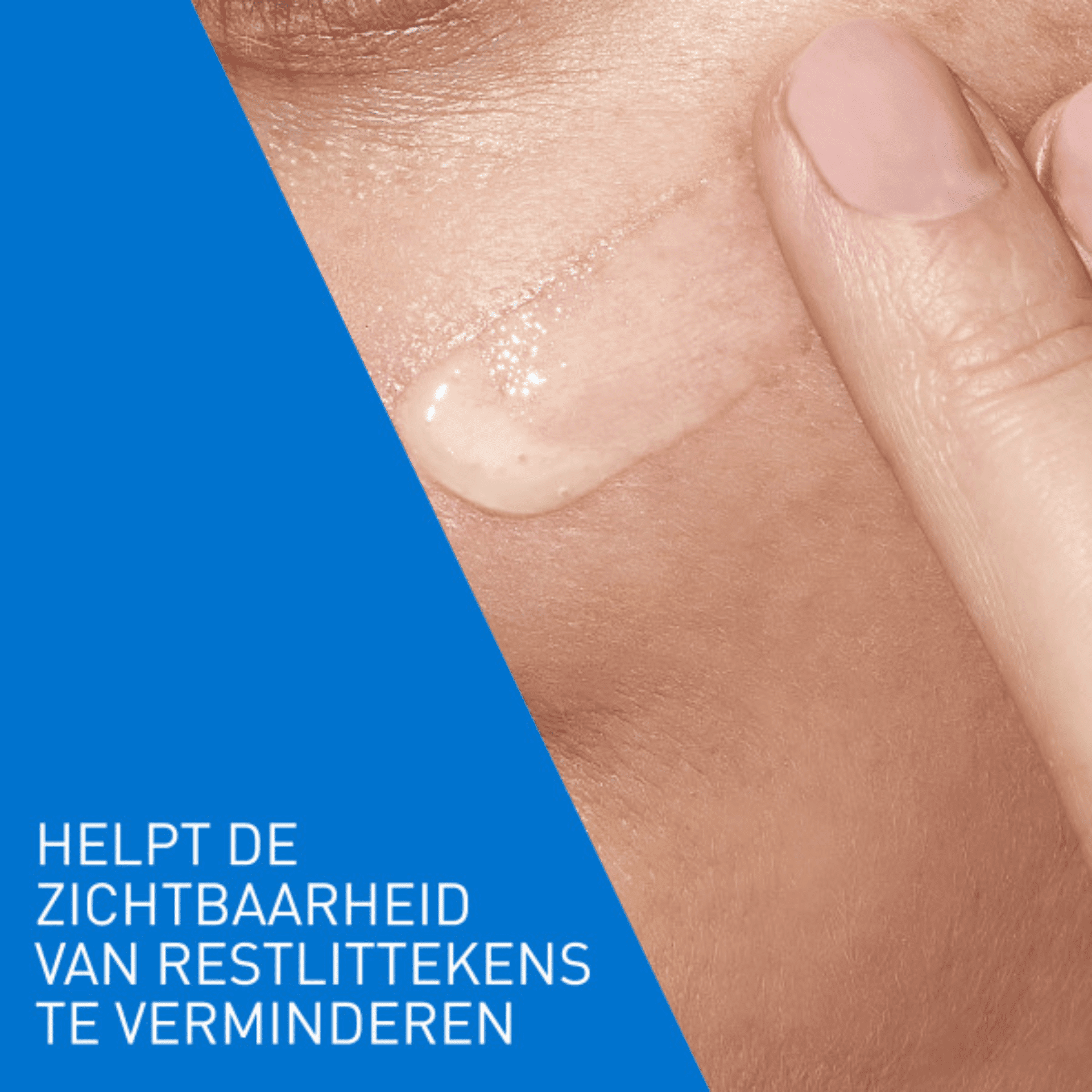 CeraVe Retinolserum tegen Vlekken