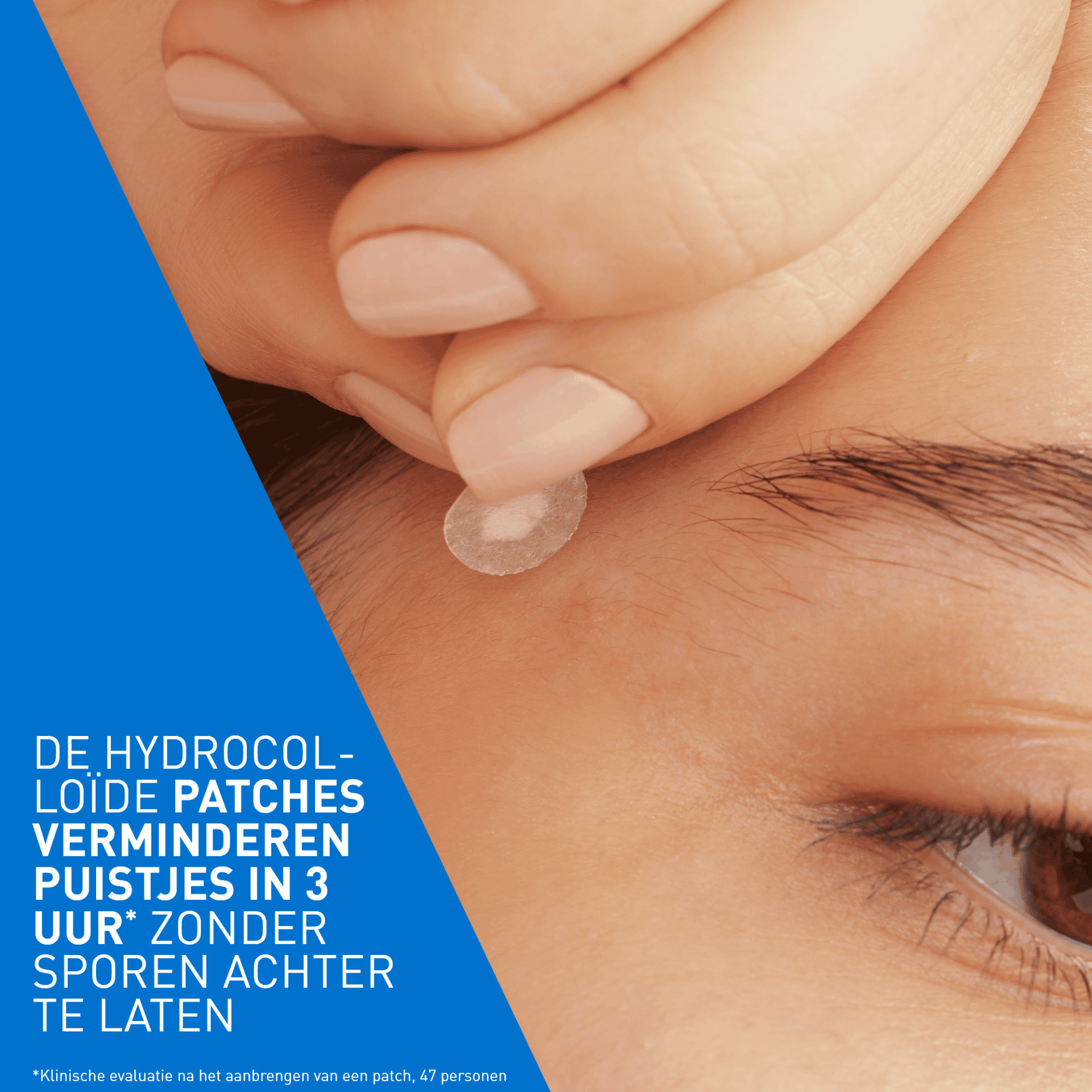 CeraVe Anti-Imperfections Patch CeraVe Anti-Imperfections Patch