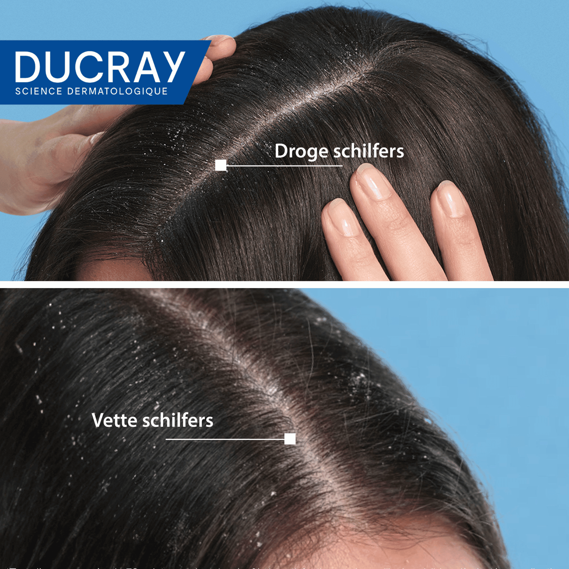 Ducray Kelual Squanorm Fresh Control Lotion Ducray Kelual Squanorm Fresh Control Lotion