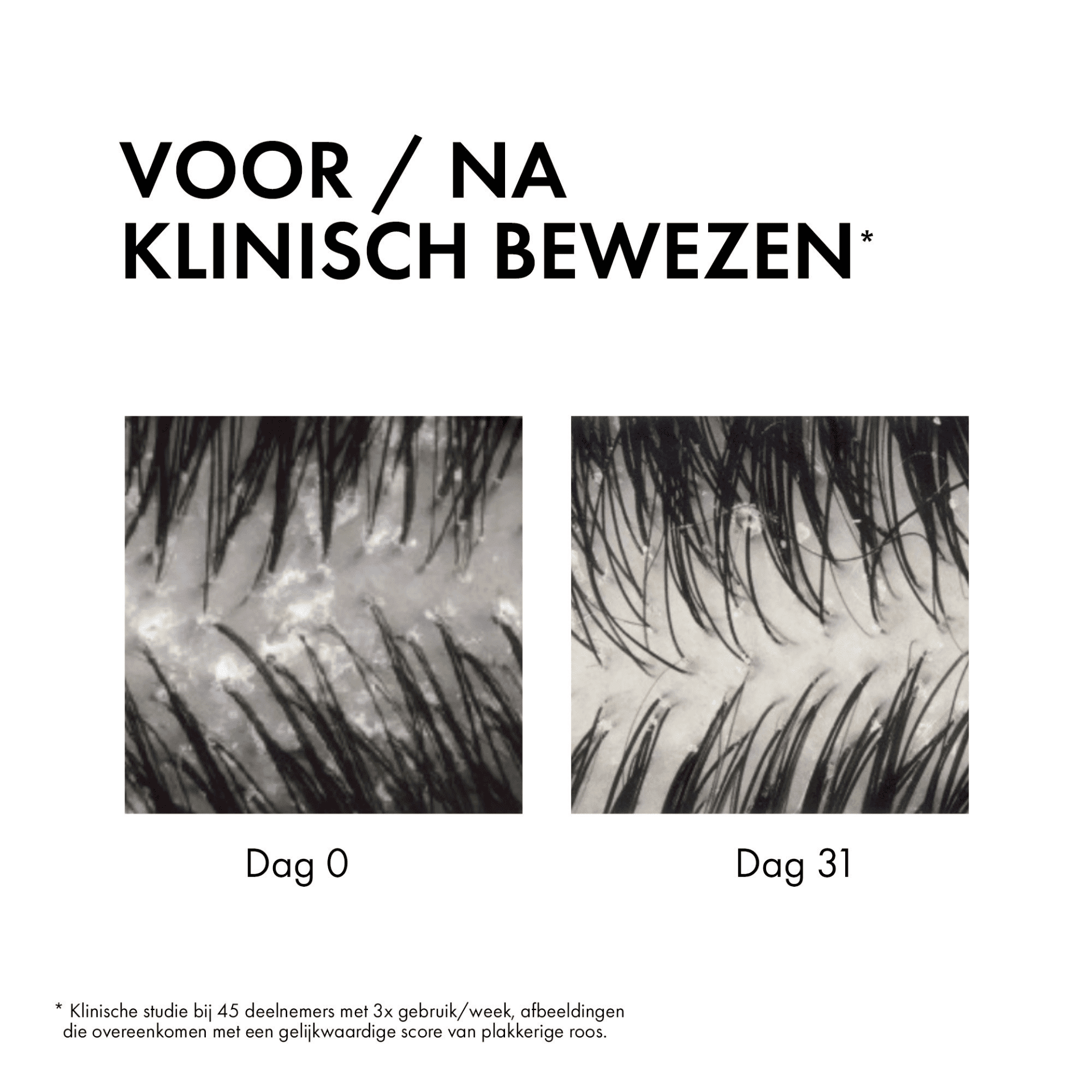 Vichy Dercos Anti-Roos DS 2-in-1 Shampoo & Conditioner Vichy Dercos Anti-Roos DS 2-in-1 Shampoo & Conditioner