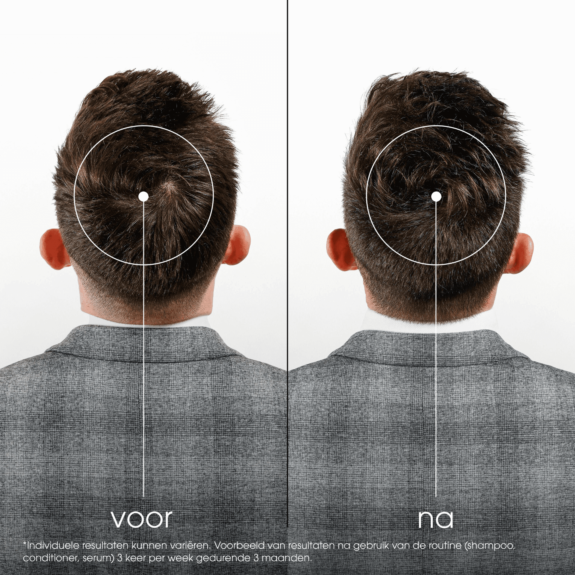 Klorane Kinine Conditioner tegen Haaruitval