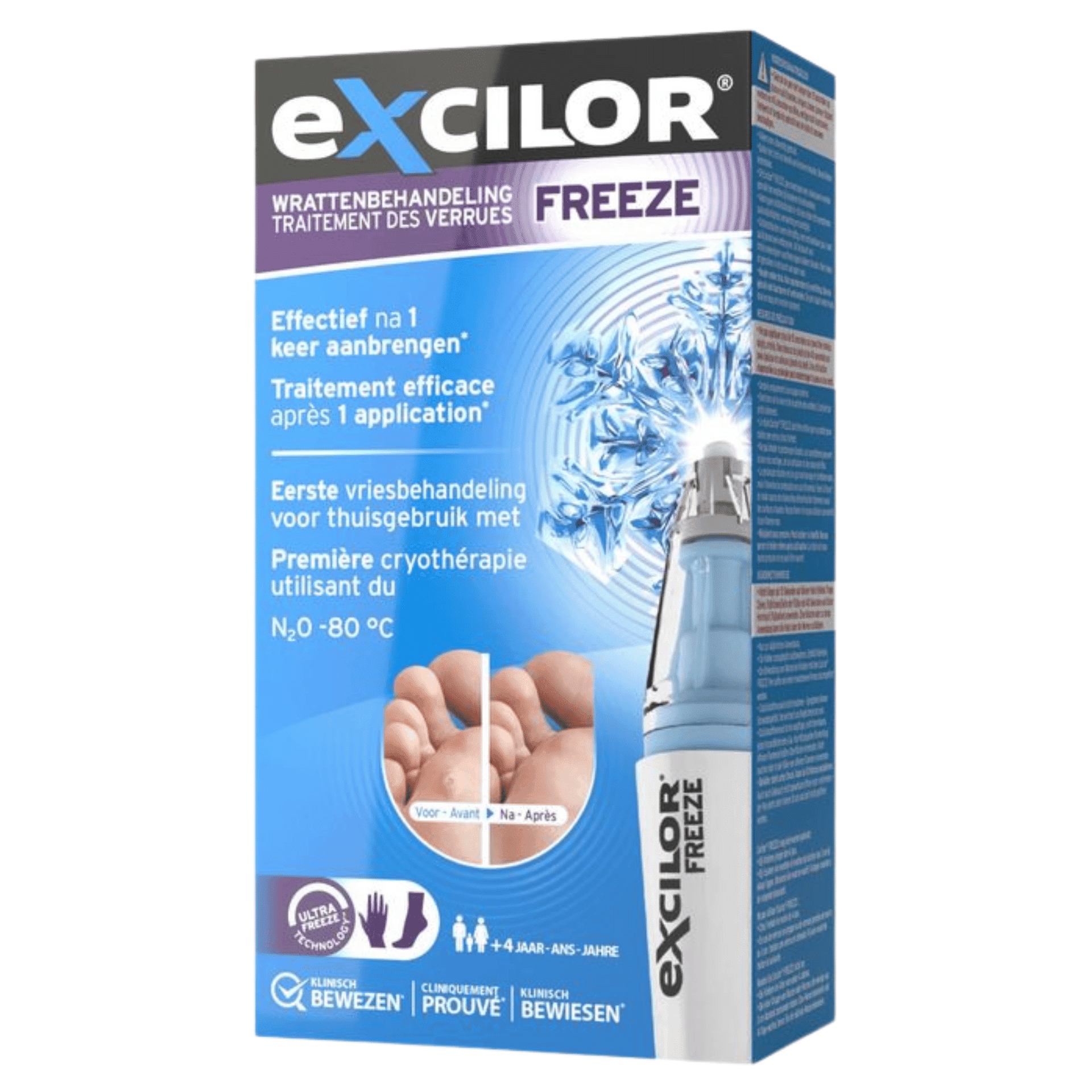 Excilor Wrattenbehandeling Freeze