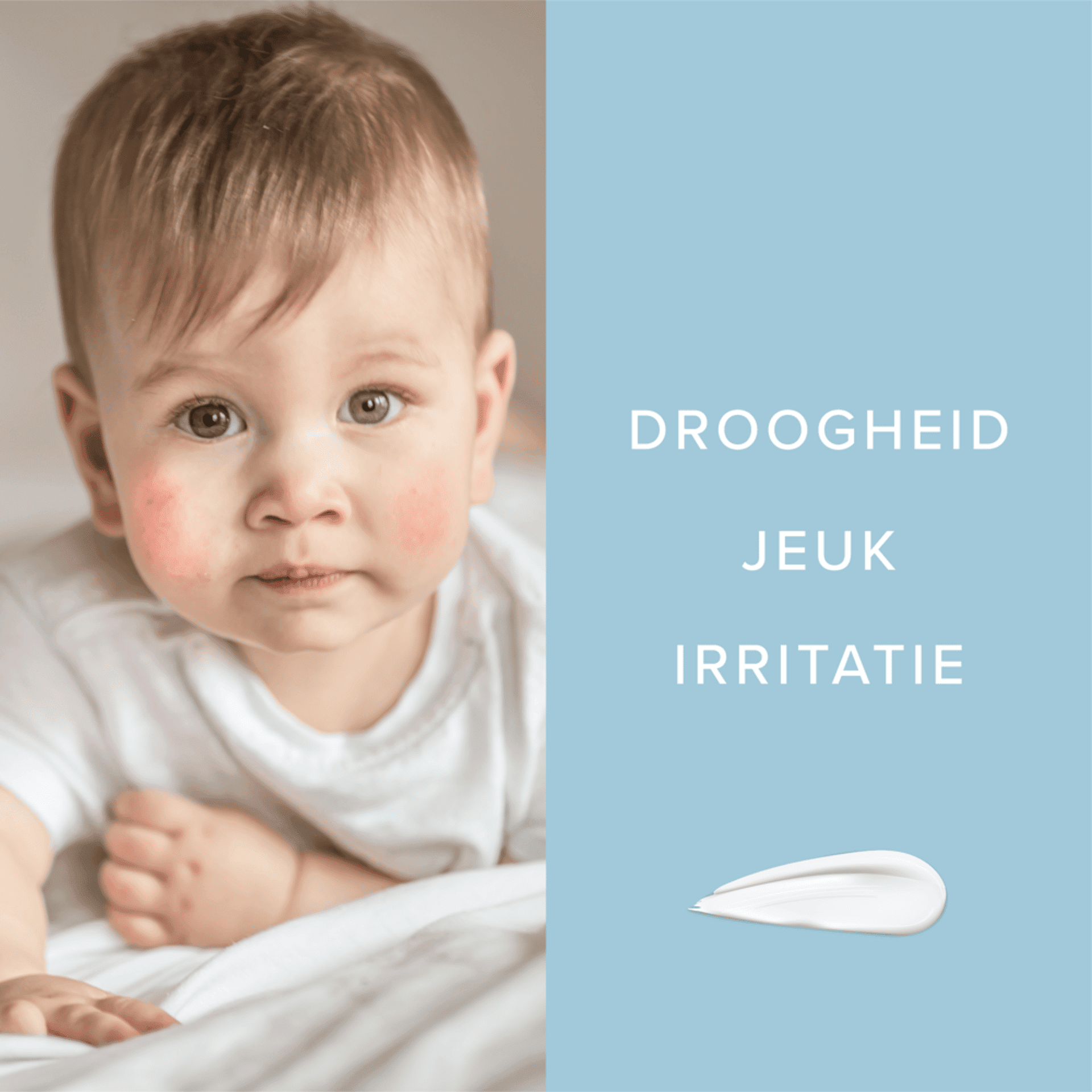 Dermalex Atopisch Eczema Crème Baby