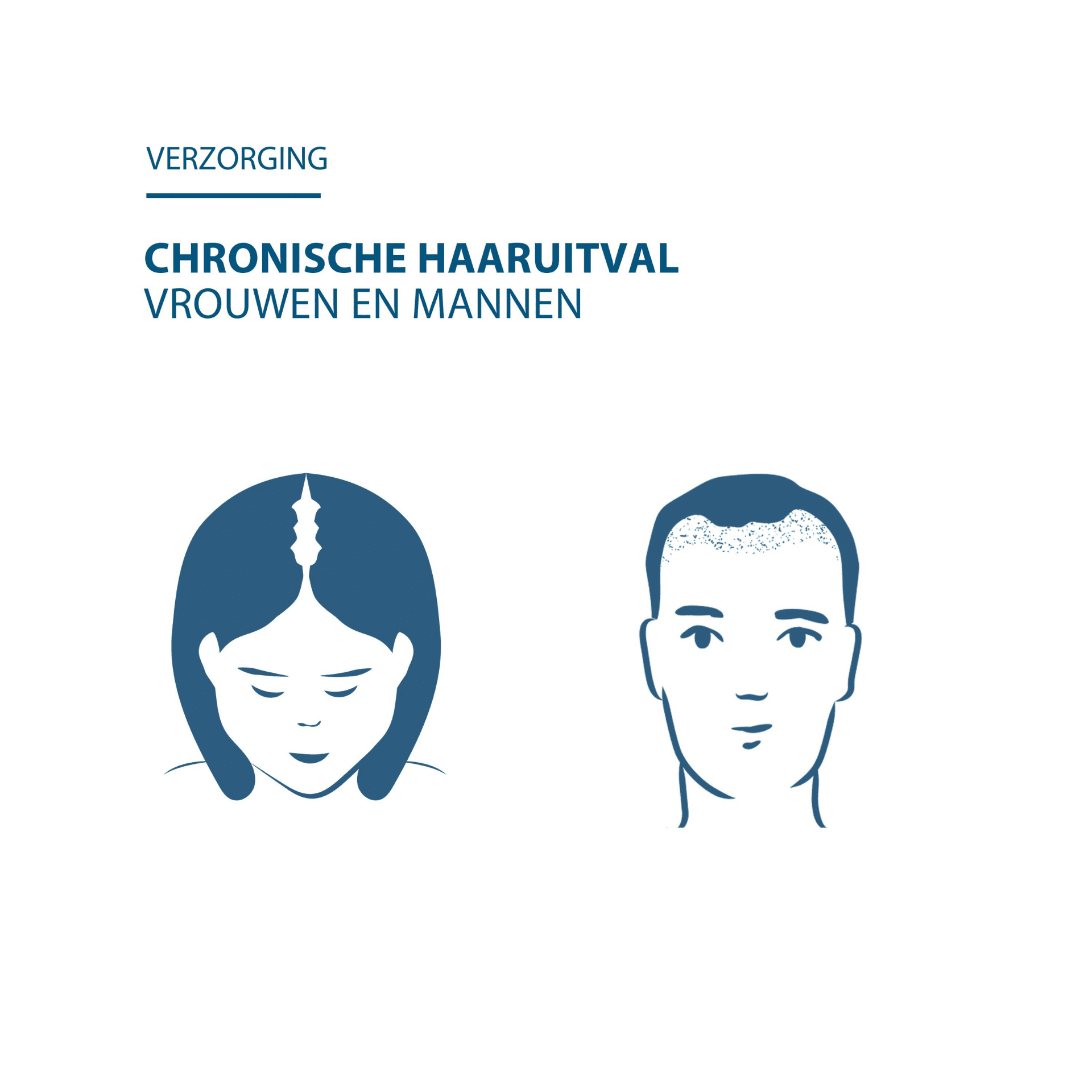 Ducray Anacaps Expert Chronische Haaruitval