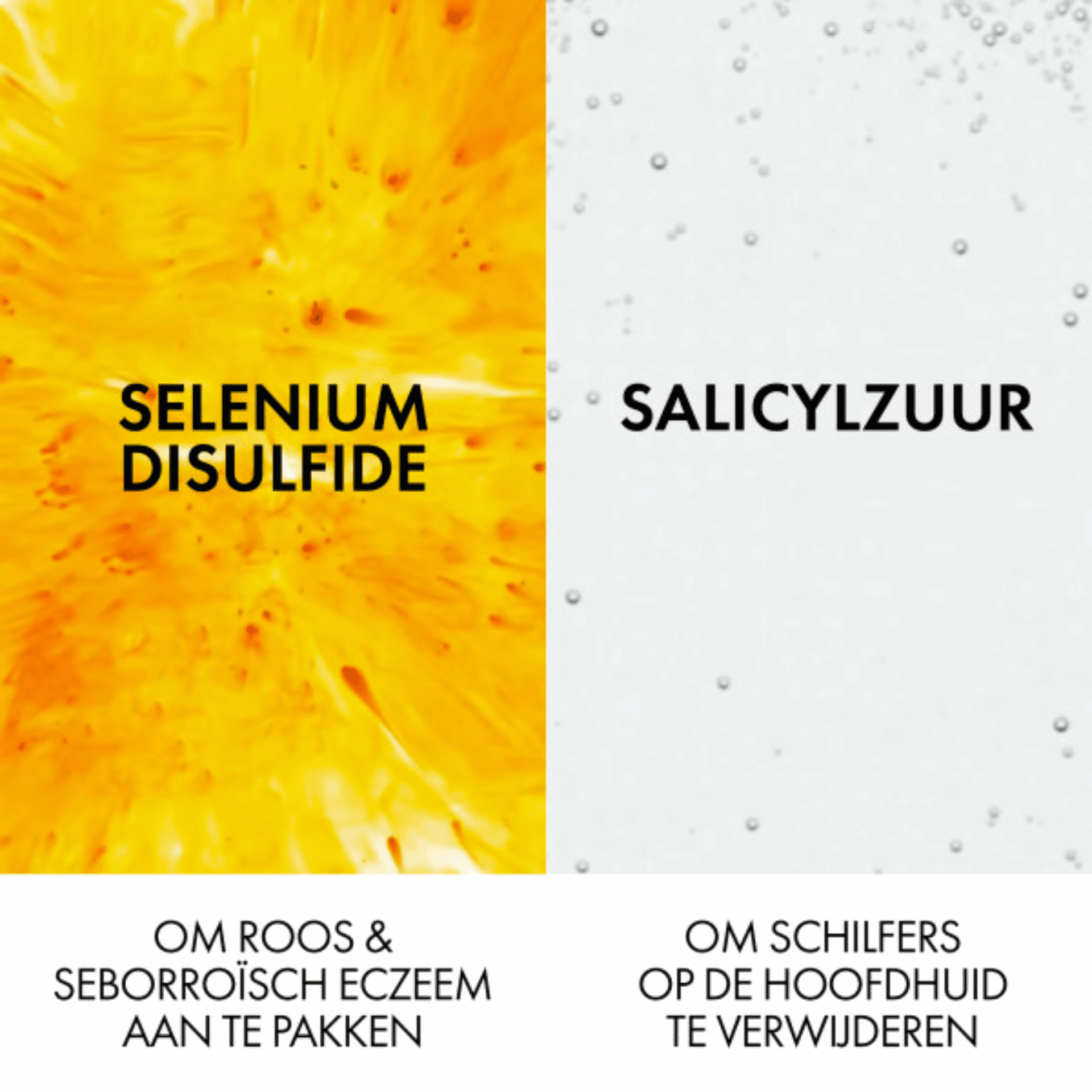 Vichy Dercos Anti-Roos DS Normaal tot Vet Haar Vichy Dercos Anti-Roos DS Normaal tot Vet Haar