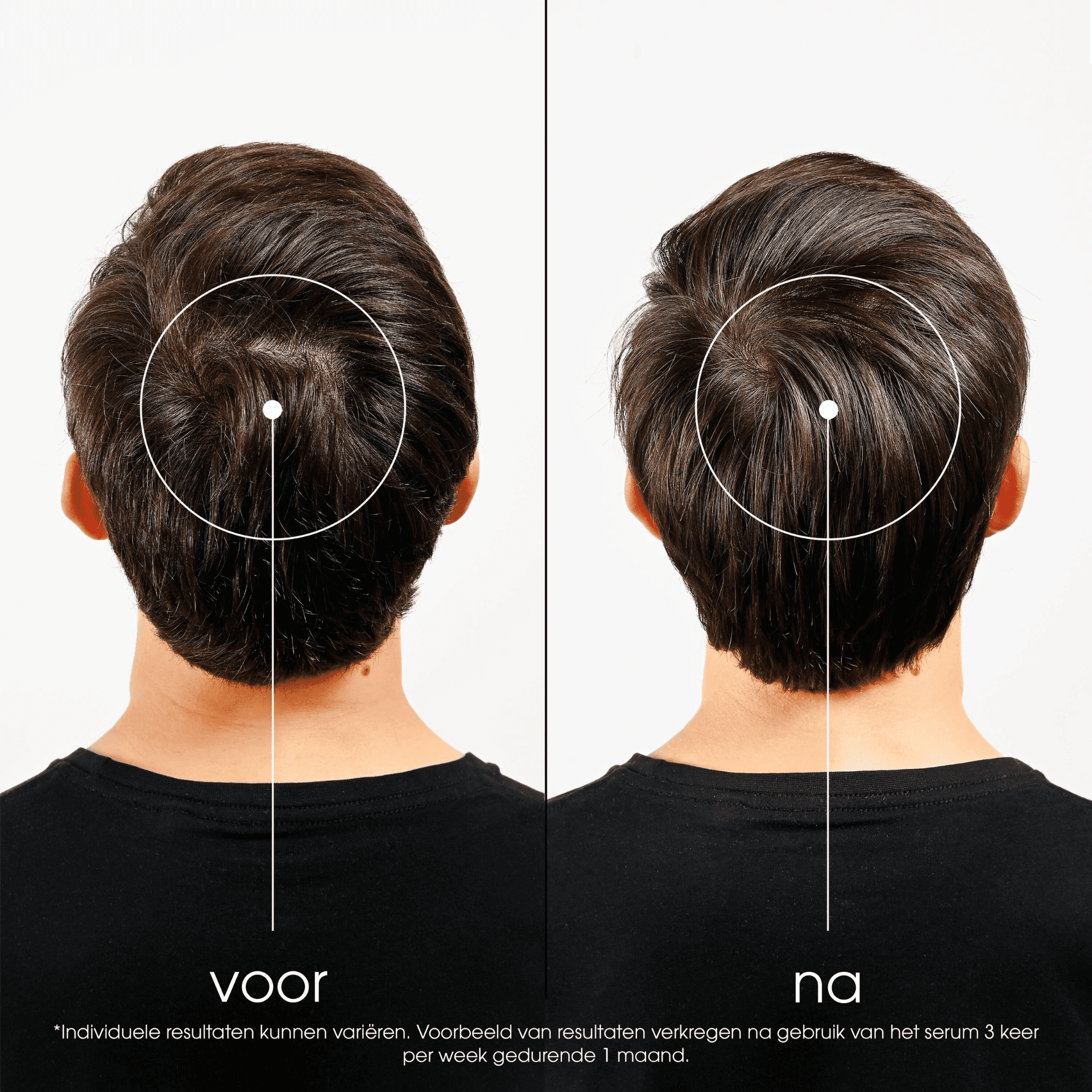 Klorane Kinine Intensieve Behandeling tegen Haarverlies Klorane Kinine Intensieve Behandeling tegen Haarverlies