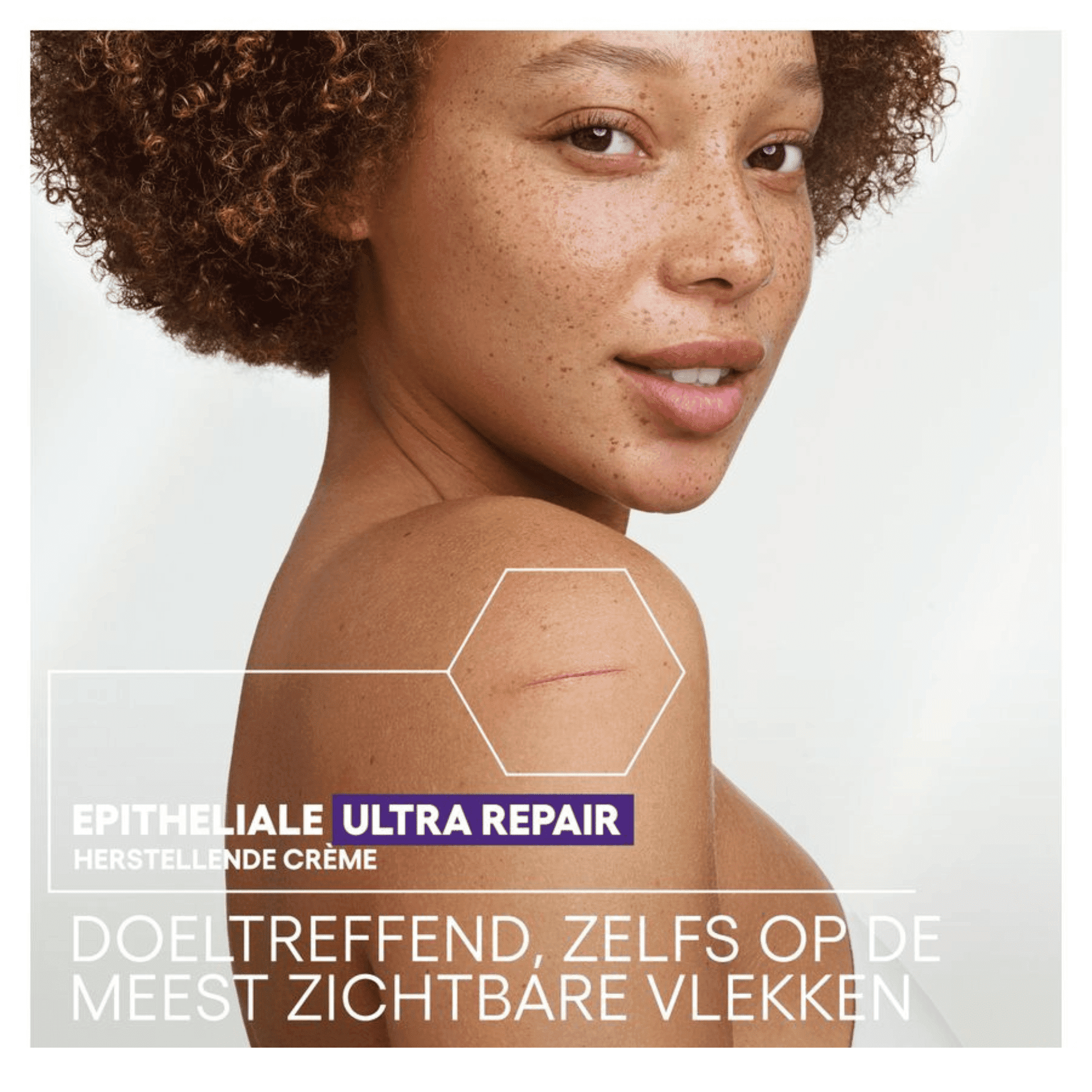 A-Derma Epitheliale Ultra Repair HA+ Herstellende Crème tegen Littekens A-Derma Epitheliale Ultra Repair HA+ Herstellende Crème tegen Littekens