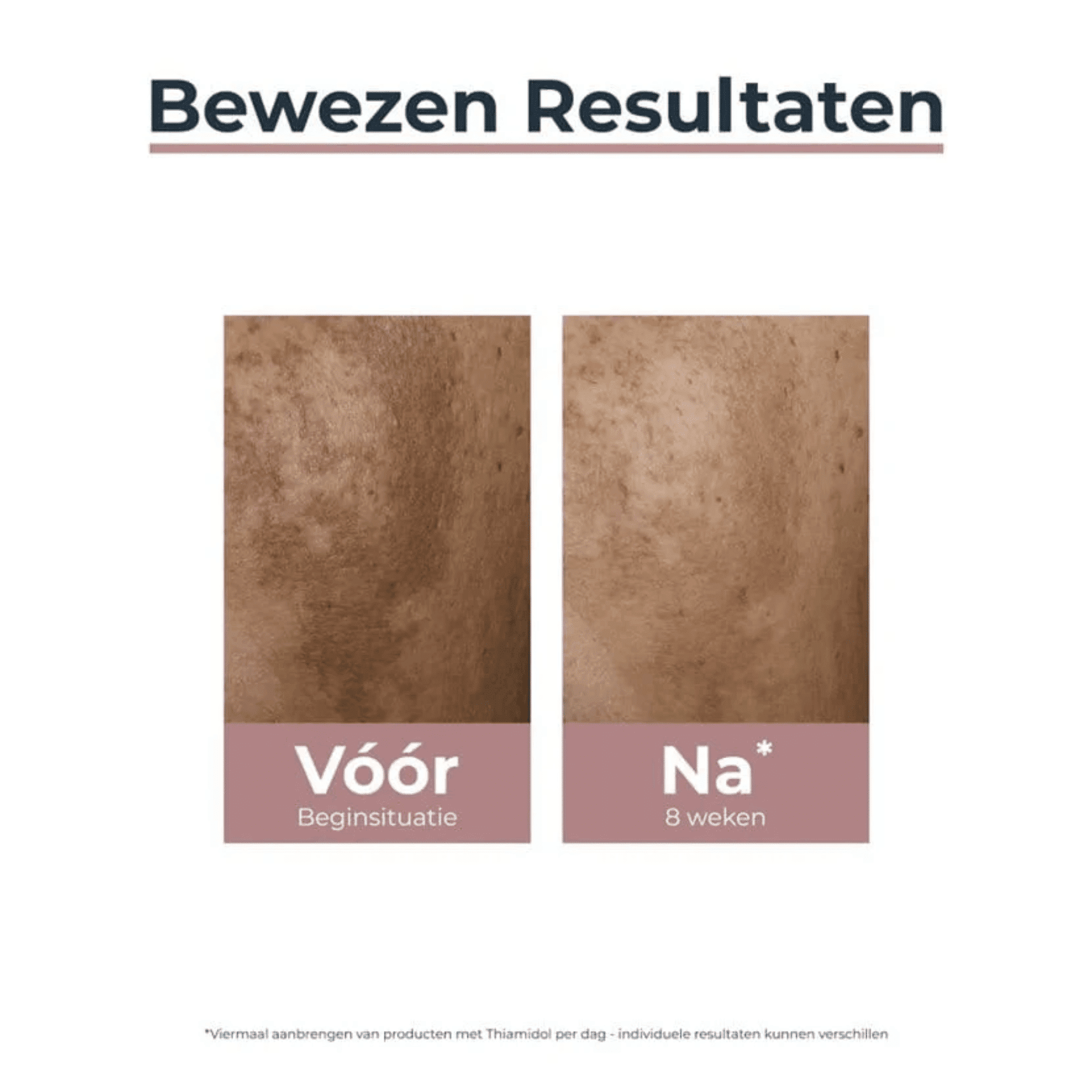 Eucerin Anti-Pigment Spot Corrector Eucerin Anti-Pigment Spot Corrector