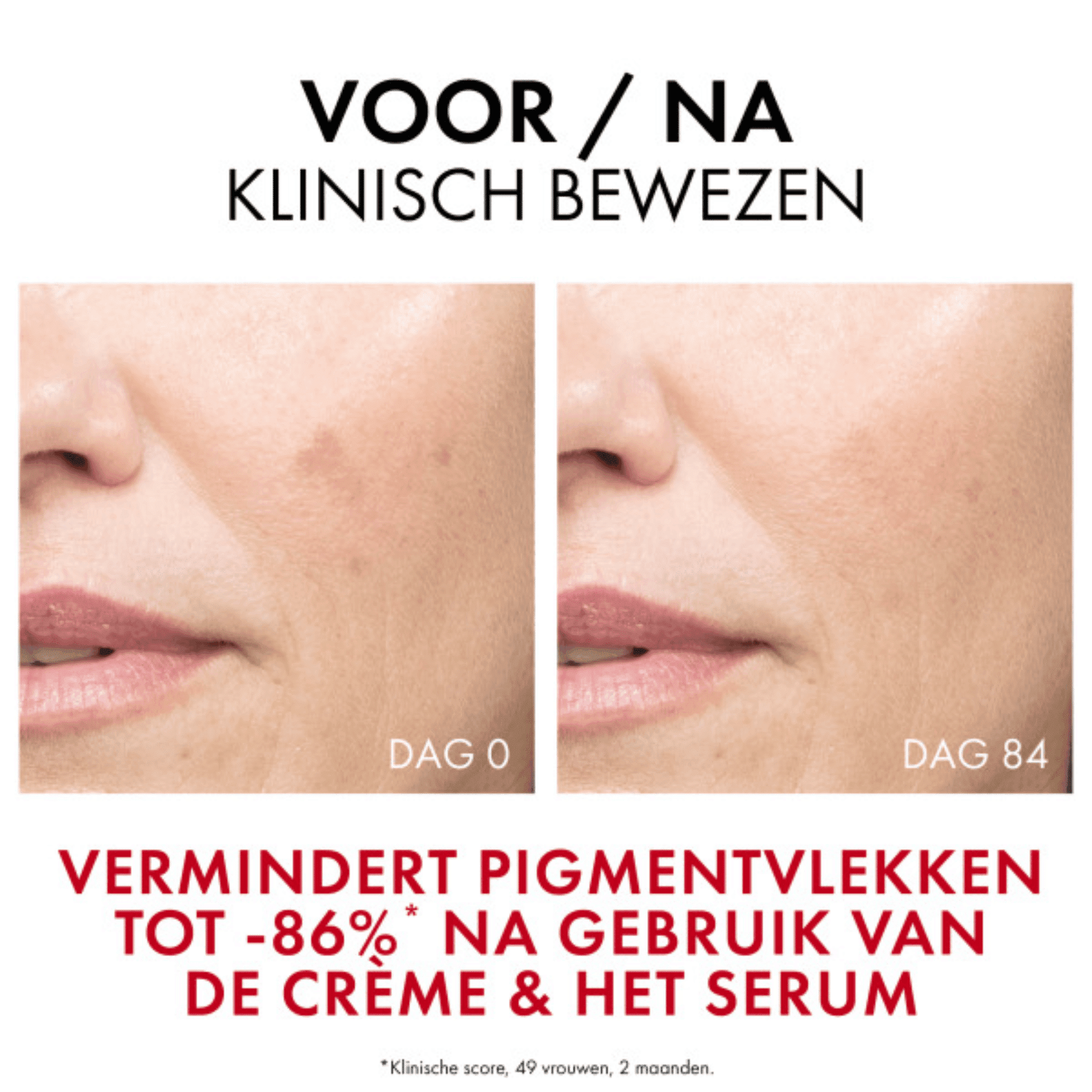 Vichy Liftactiv Pigment Specialist B3 Serum Vichy Liftactiv Pigment Specialist B3 Serum