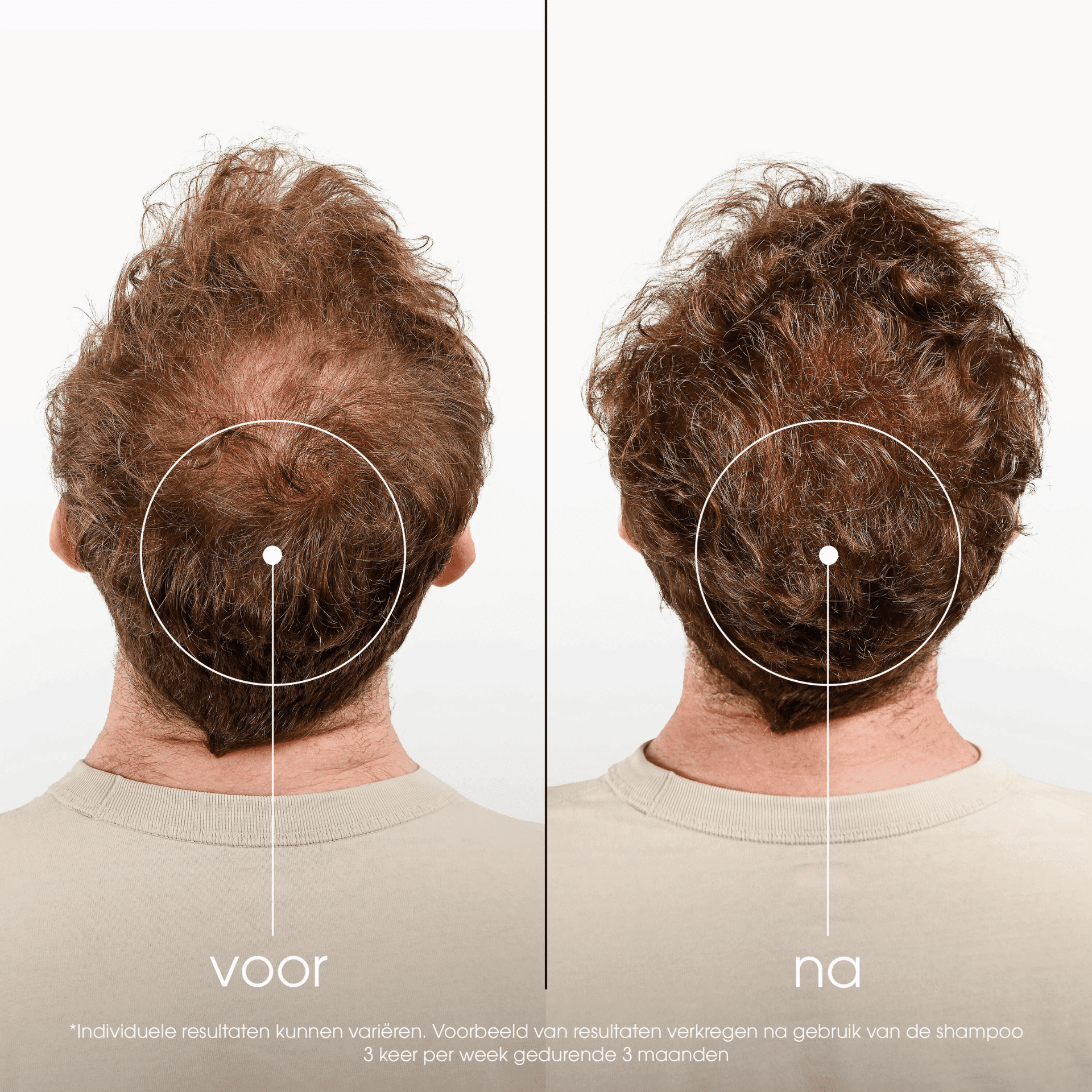 Klorane Kinine Shampoo tegen Haarverlies Klorane Kinine Shampoo tegen Haarverlies