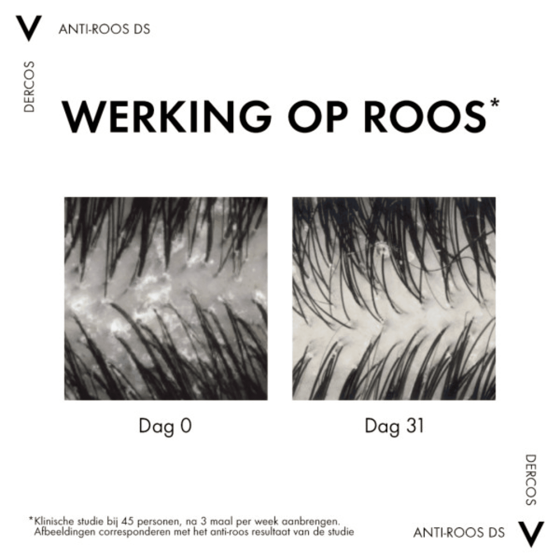 Vichy Dercos Anti-Roos DS Droog Haar