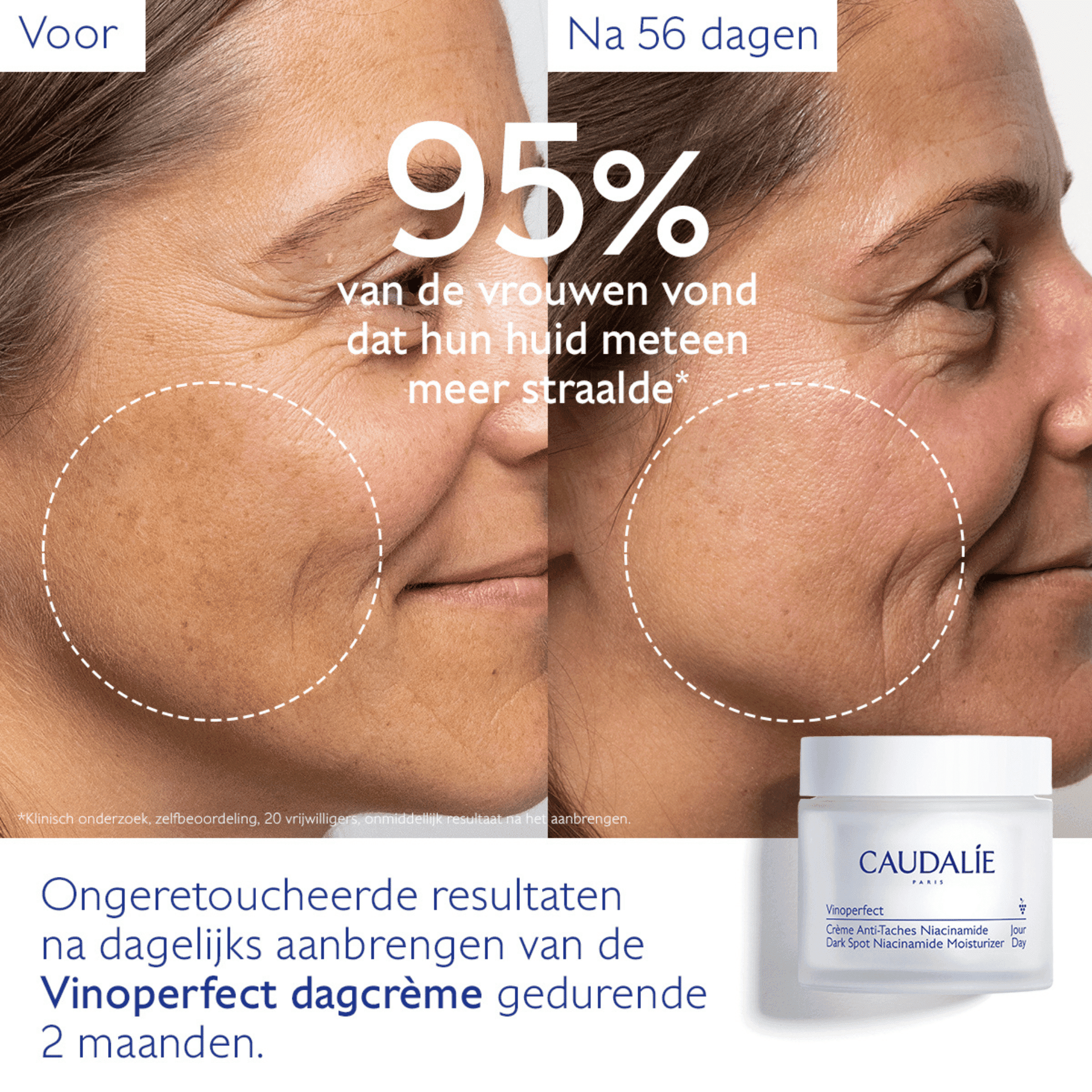 Caudalie Vinoperfect Dagcrème met Niacinamide tegen Pigmentvlekken