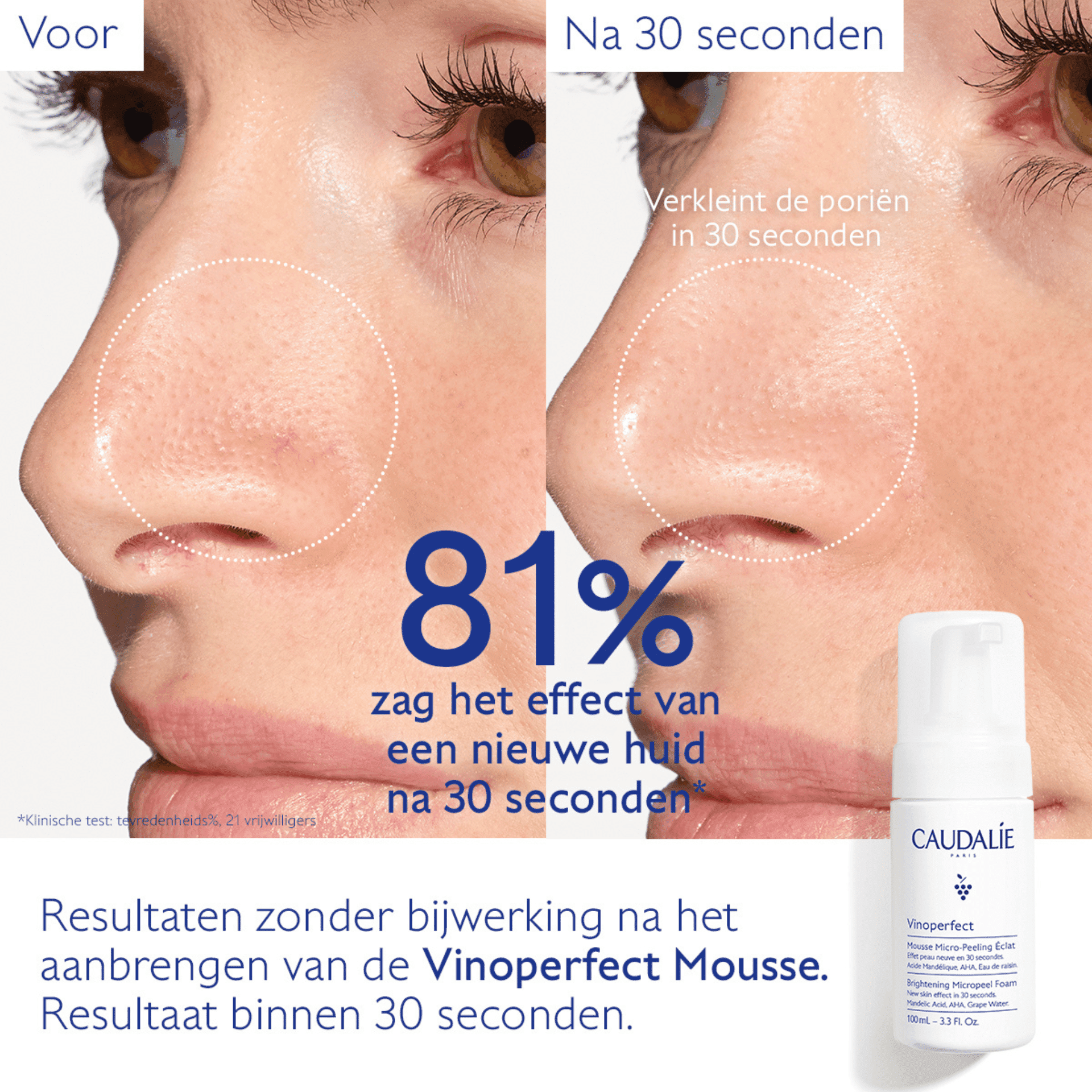 Caudalie Vinoperfect Mousse Micro-peel.eclat 100ml