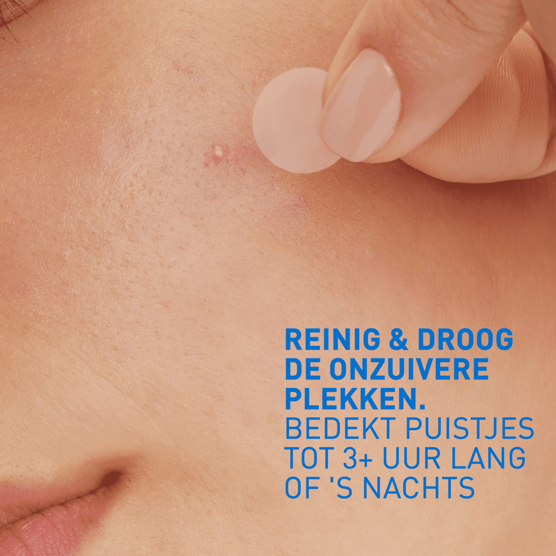CeraVe Anti-Imperfections Patch