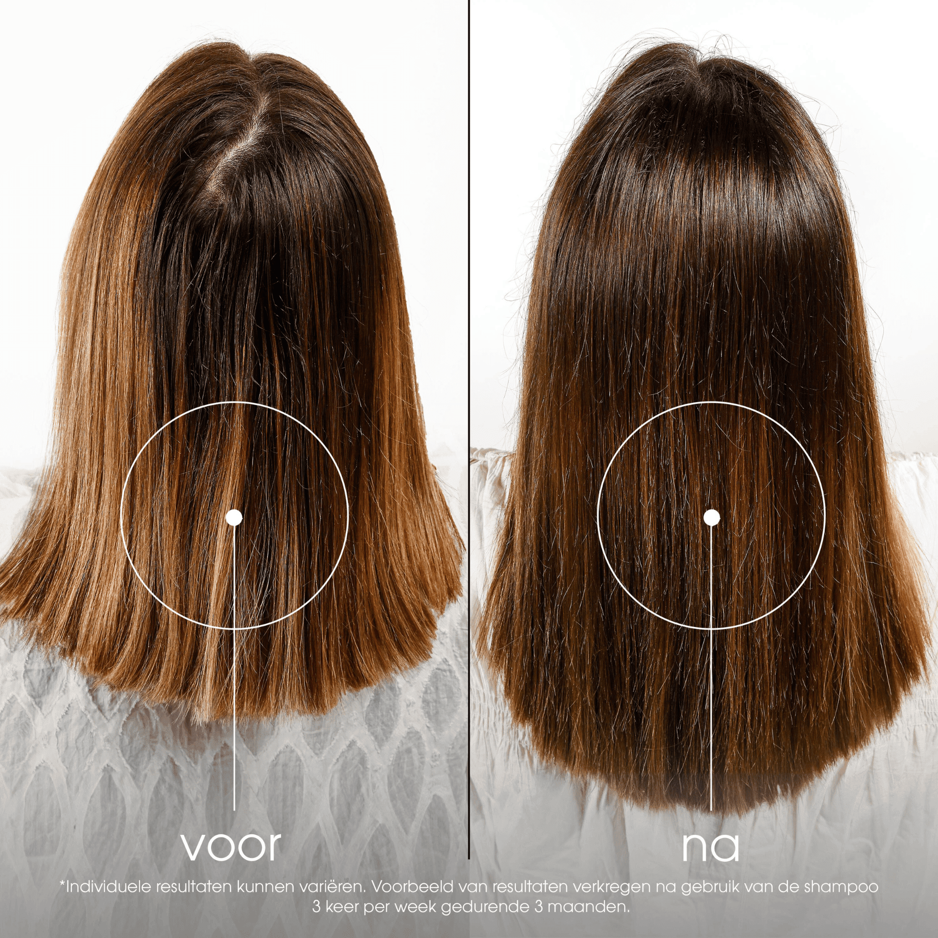 Klorane Kinine Shampoo tegen Haarverlies