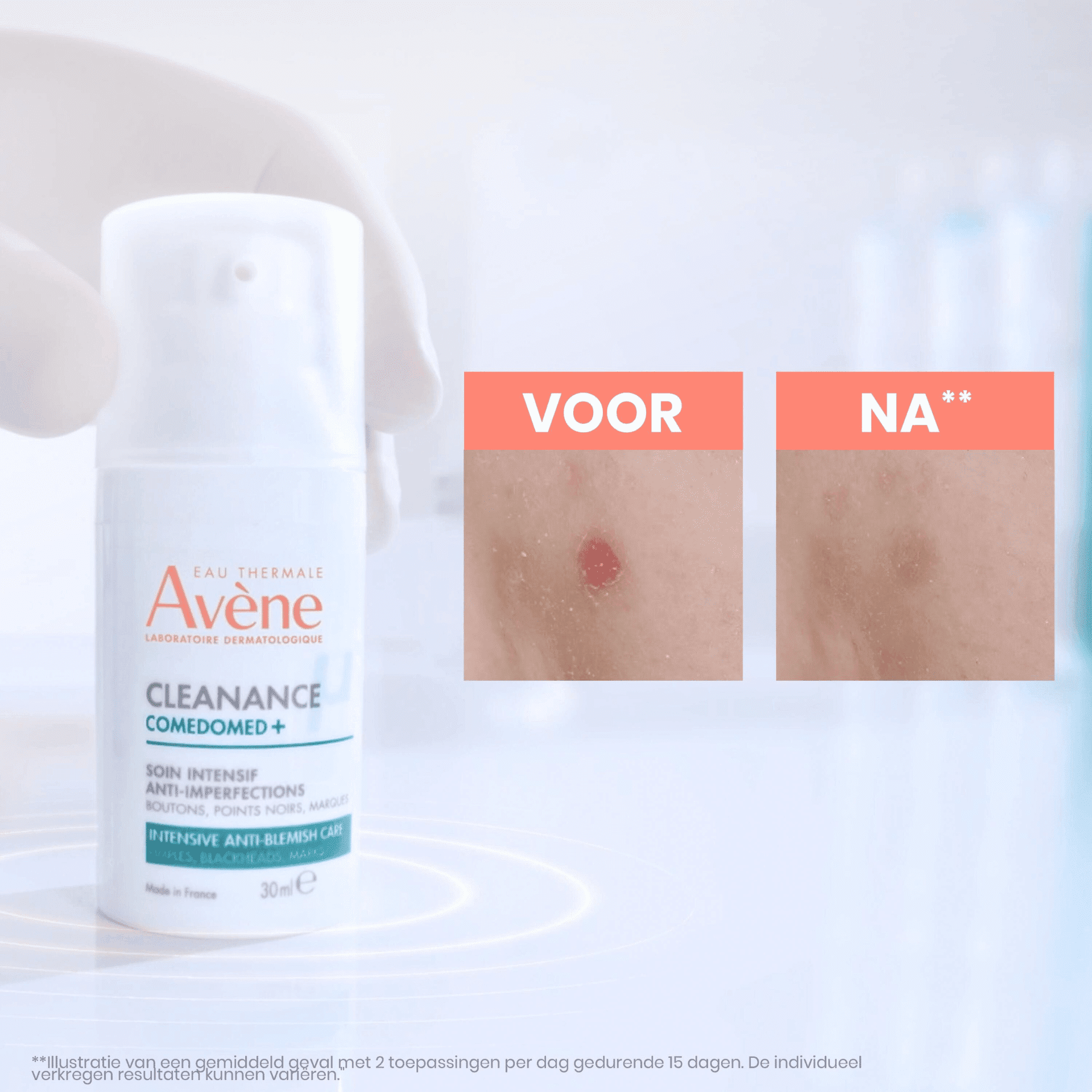 Avène Cleanance Comedomed+ Intensieve Verzorging Avène Cleanance Comedomed+ Intensieve Verzorging
