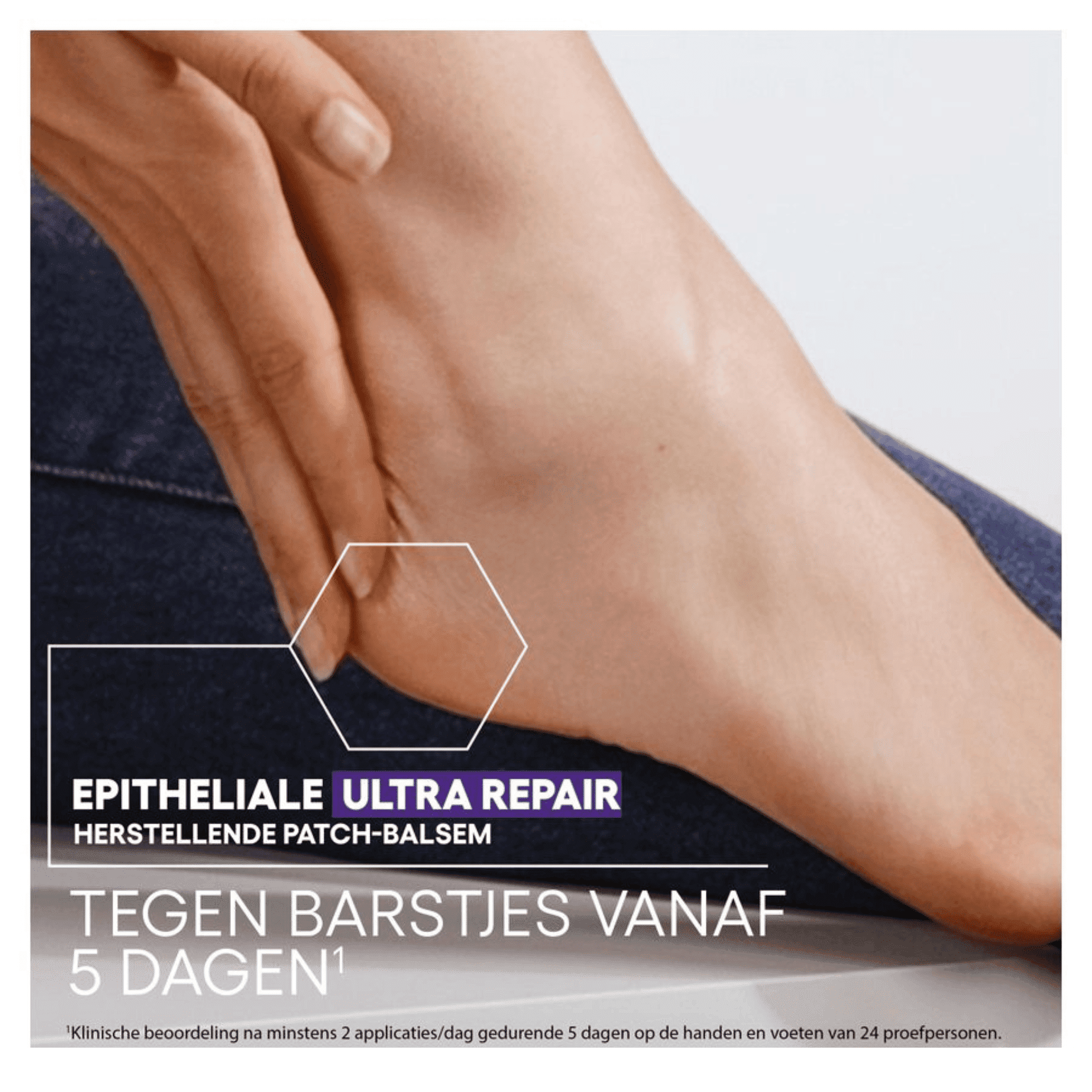 A-Derma Epitheliale Ultra Repair HA+ Herstellende Patch-Balsem A-Derma Epitheliale Ultra Repair HA+ Herstellende Patch-Balsem