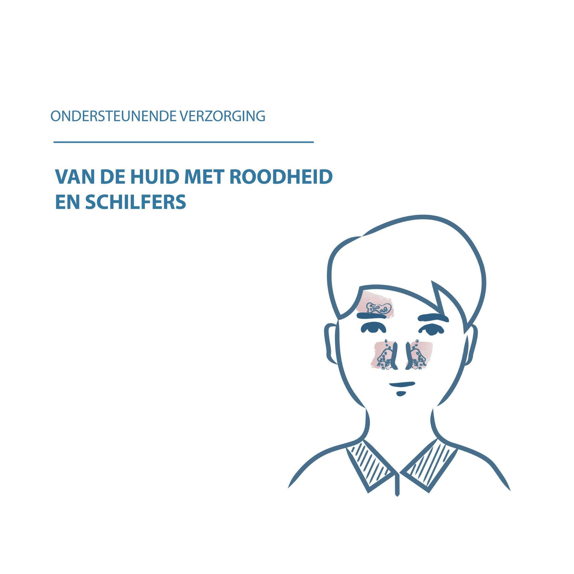 Ducray Kelual DS Kalmerende Crème Ducray Kelual DS Kalmerende Crème