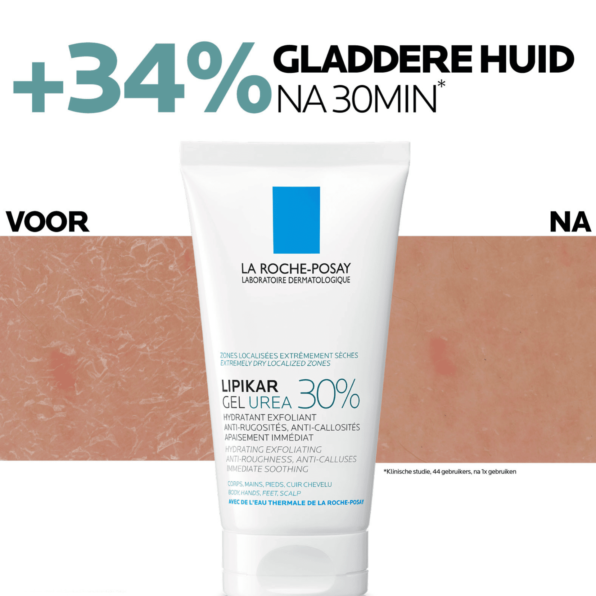 Lrp Lipikar Gel Creme Urea 30% 50ml Lrp Lipikar Gel Creme Urea 30% 50ml